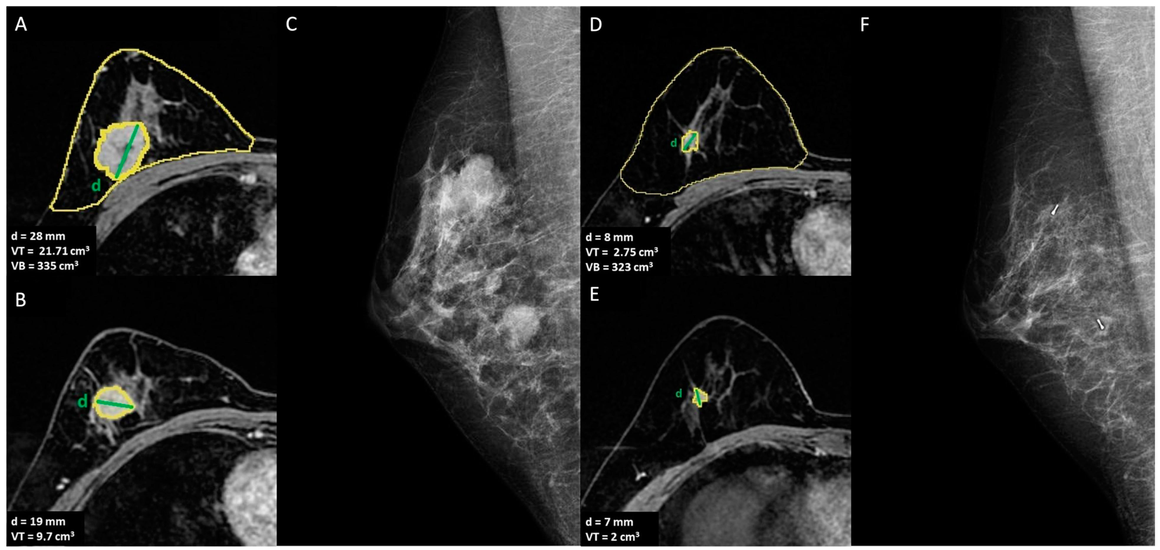 Cancers 15 01439 g002