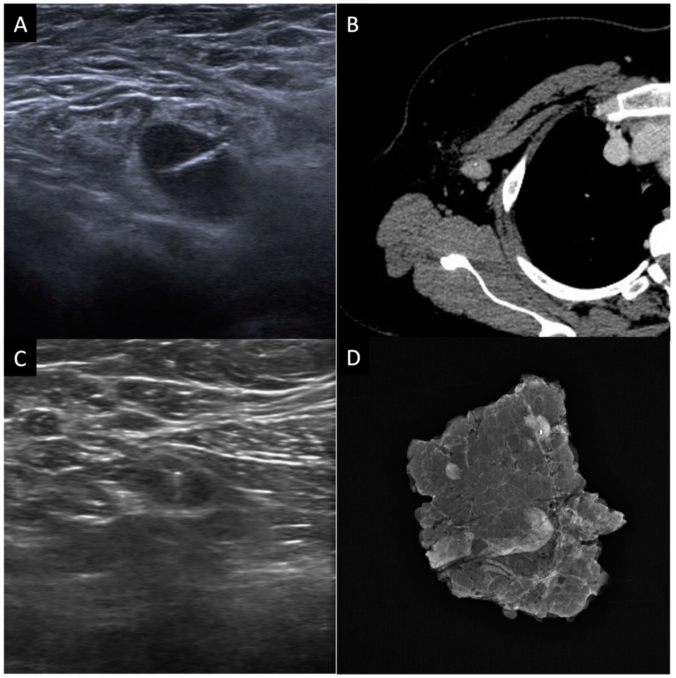 Cancers 15 01439 g003