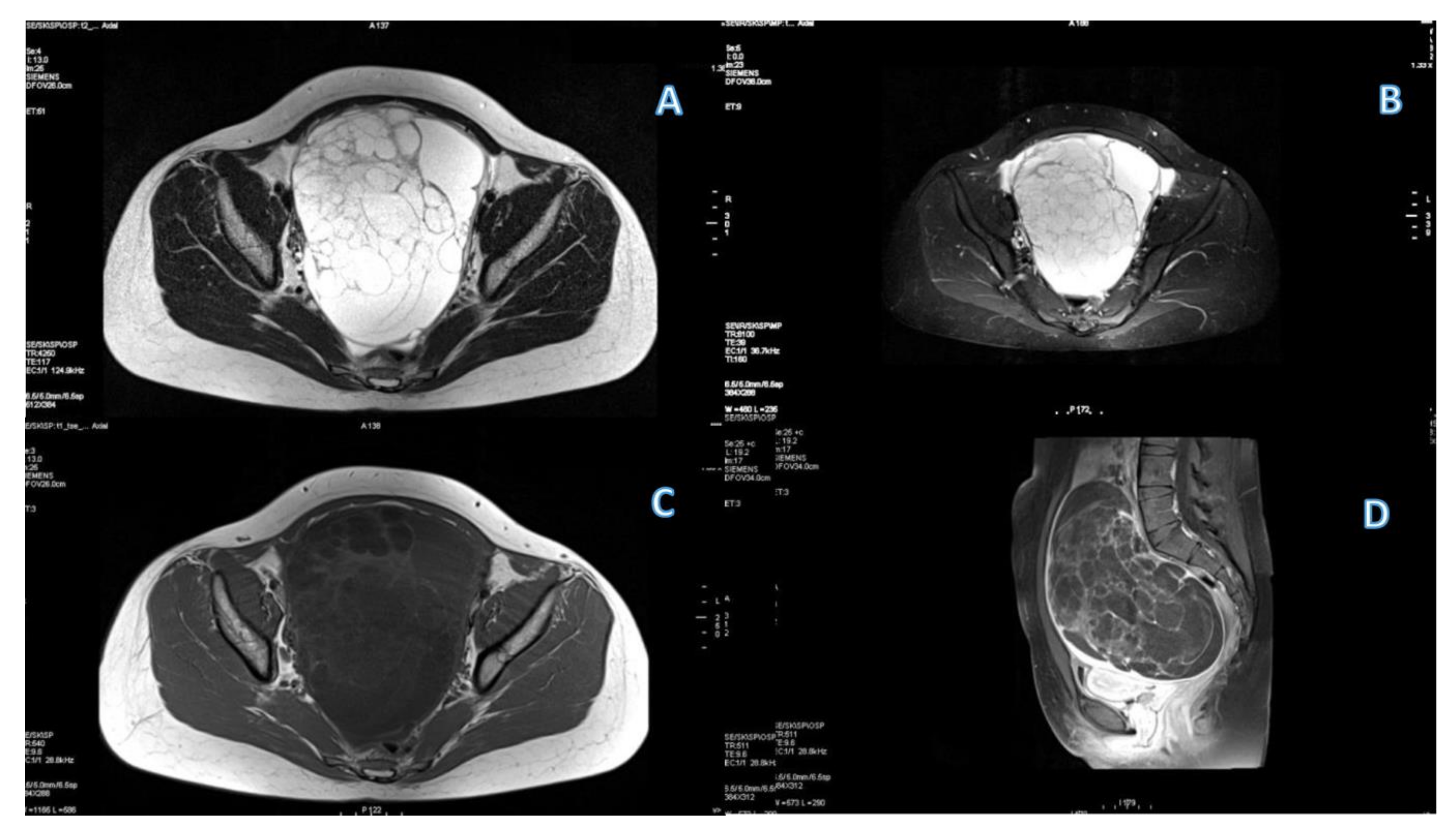 Cancers 15 01453 g004