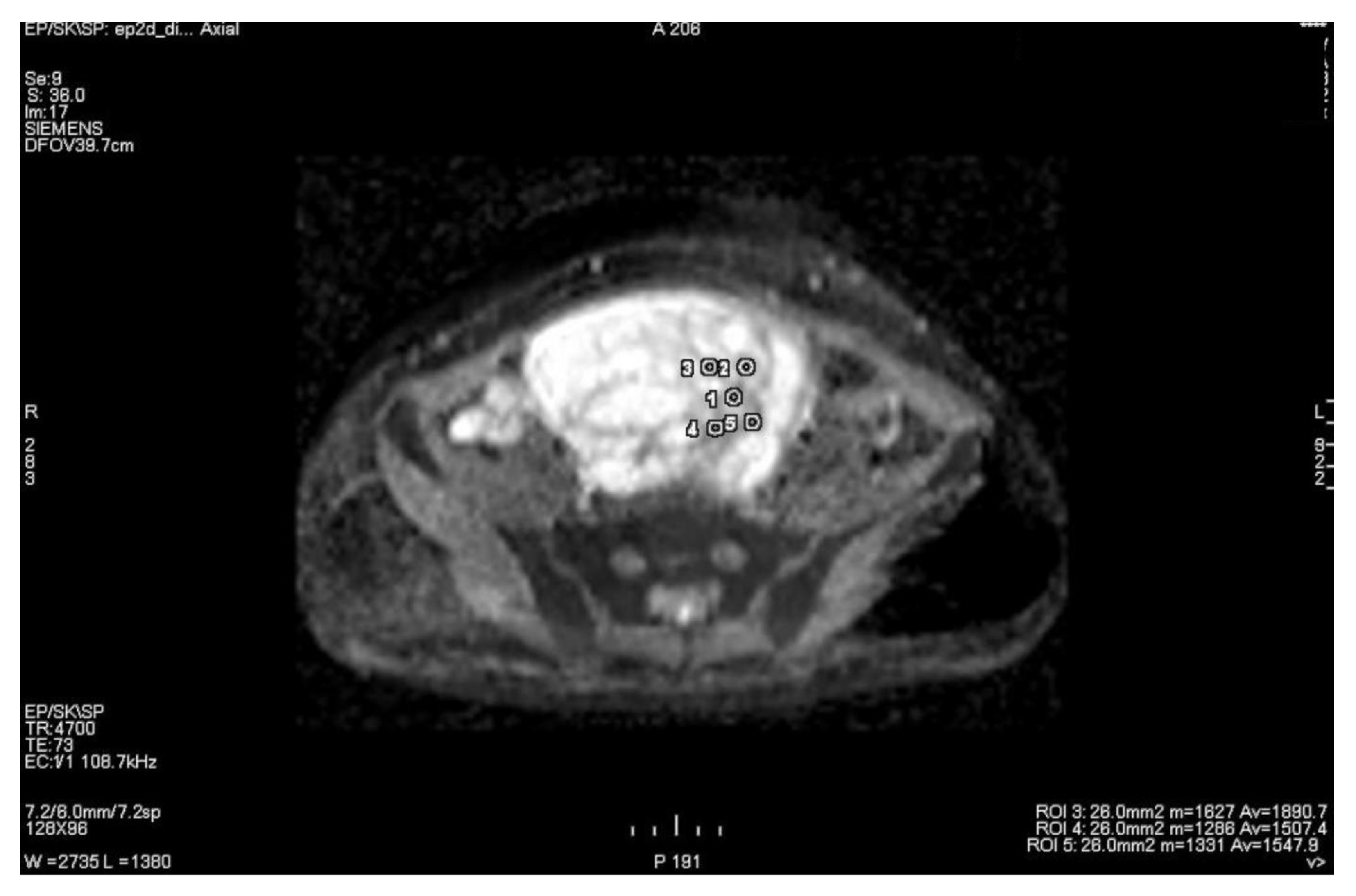 Cancers 15 01453 g005