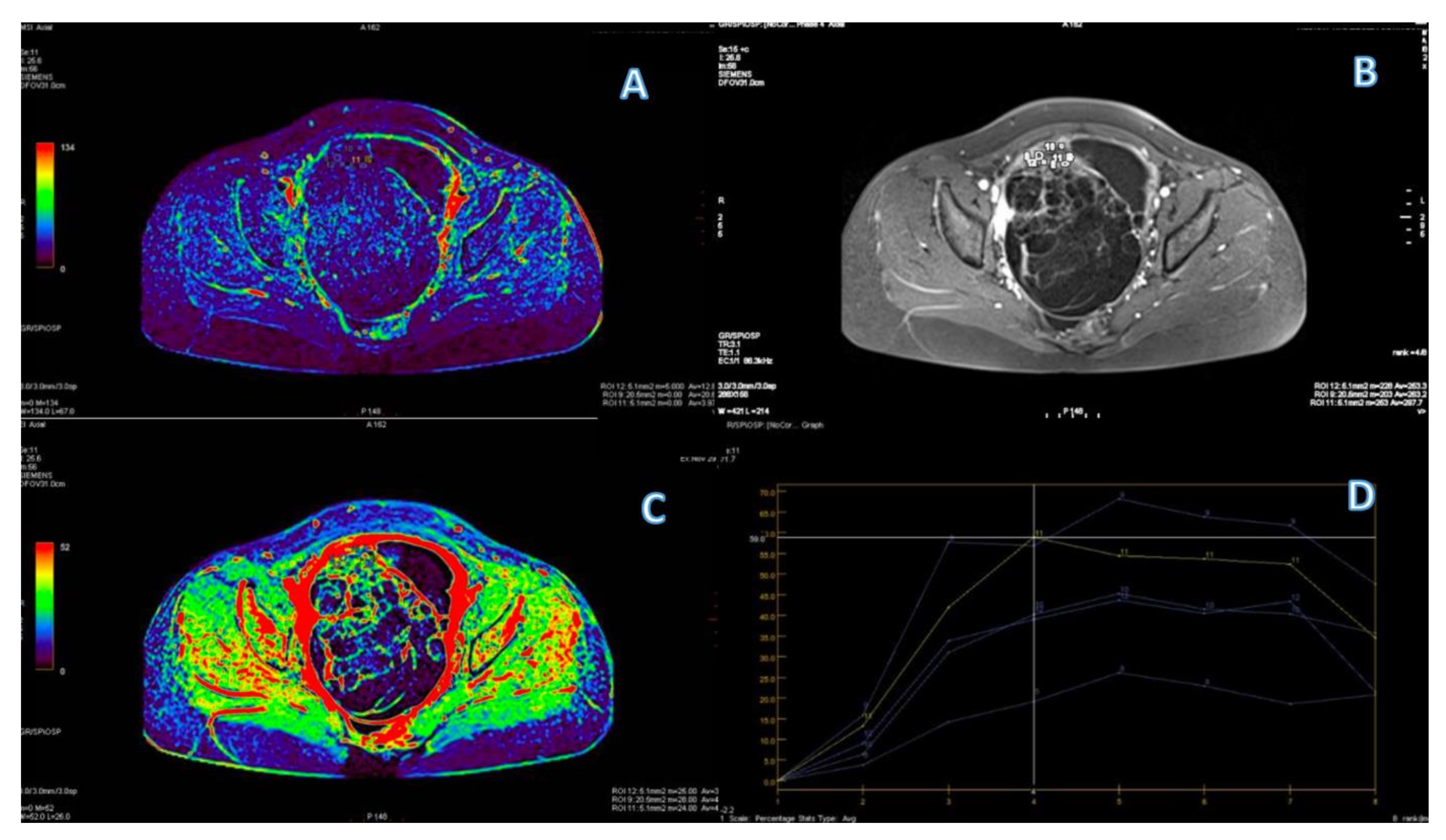 Cancers 15 01453 g006