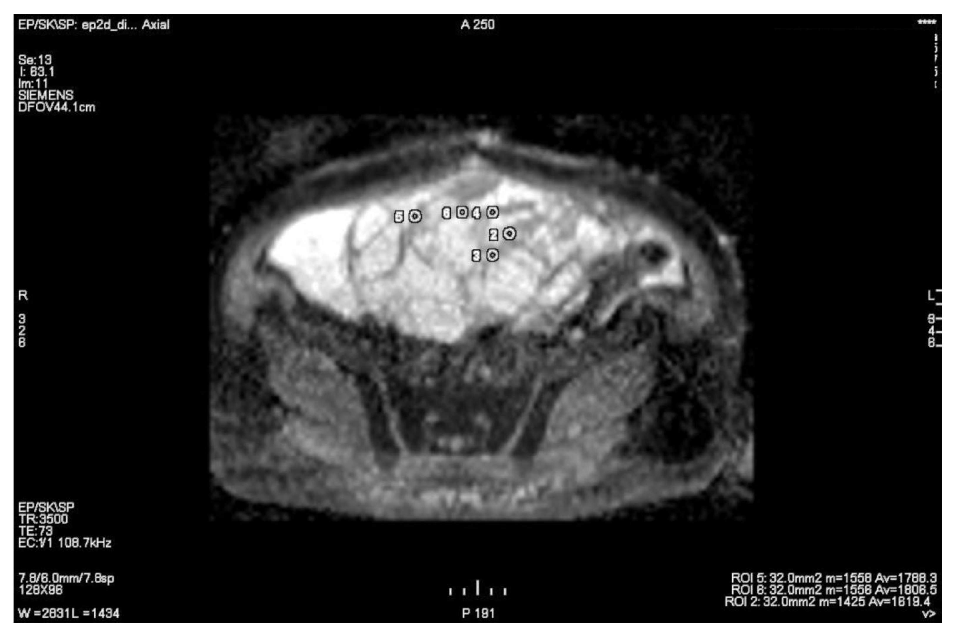 Cancers 15 01453 g007