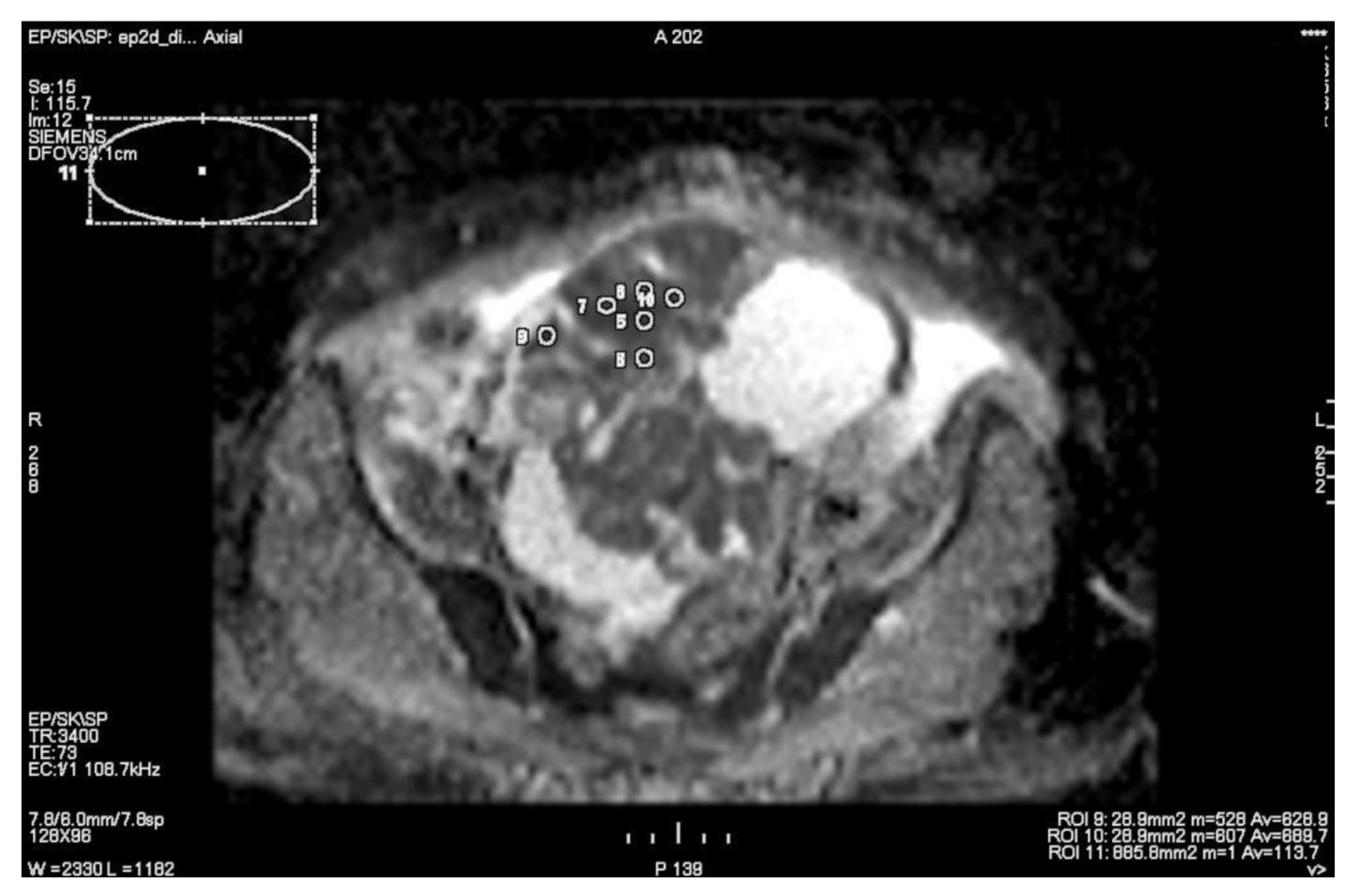 Cancers 15 01453 g009