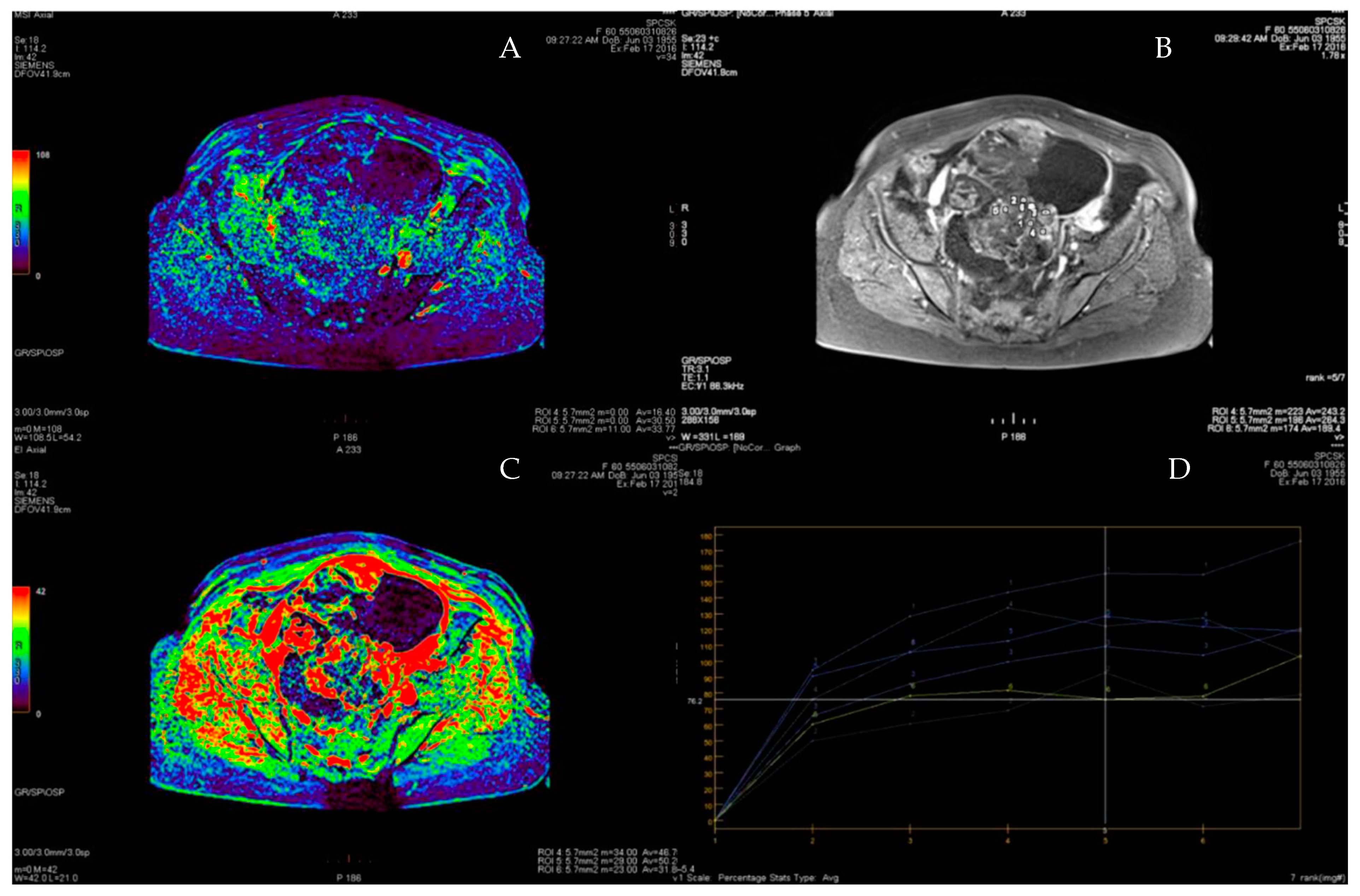 Cancers 15 01453 g010