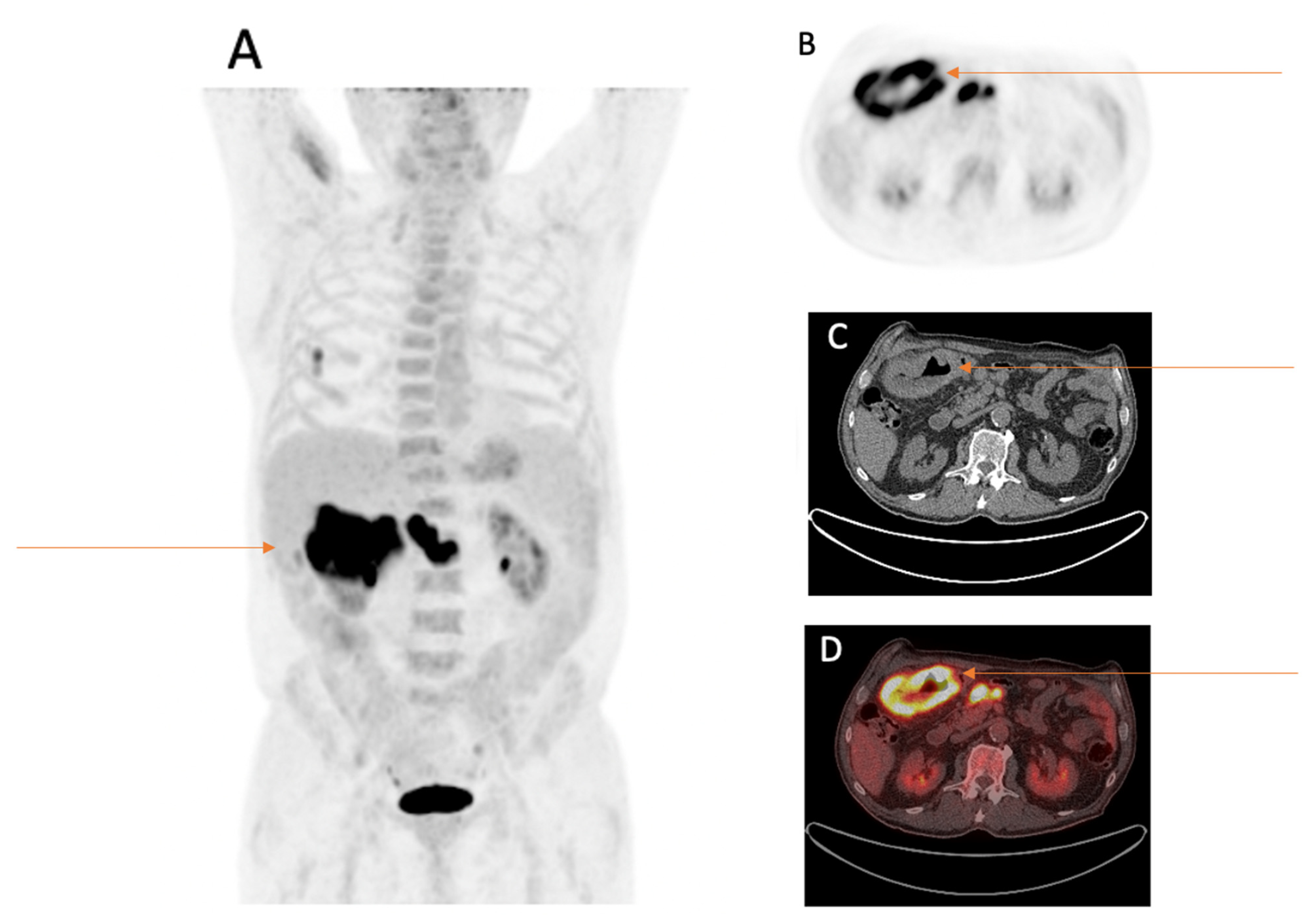 Cancers 15 01521 g003
