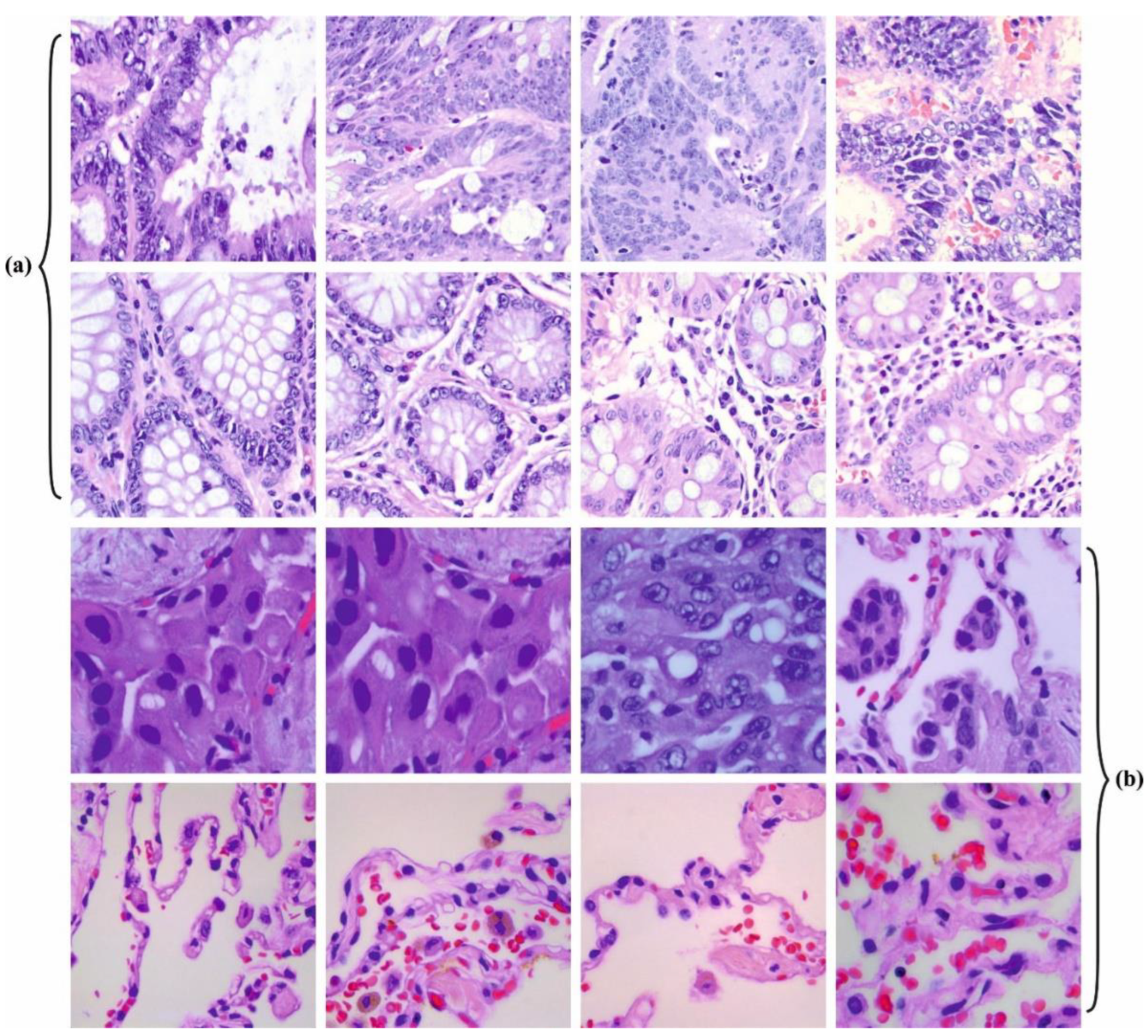 Cancers 15 01591 g003