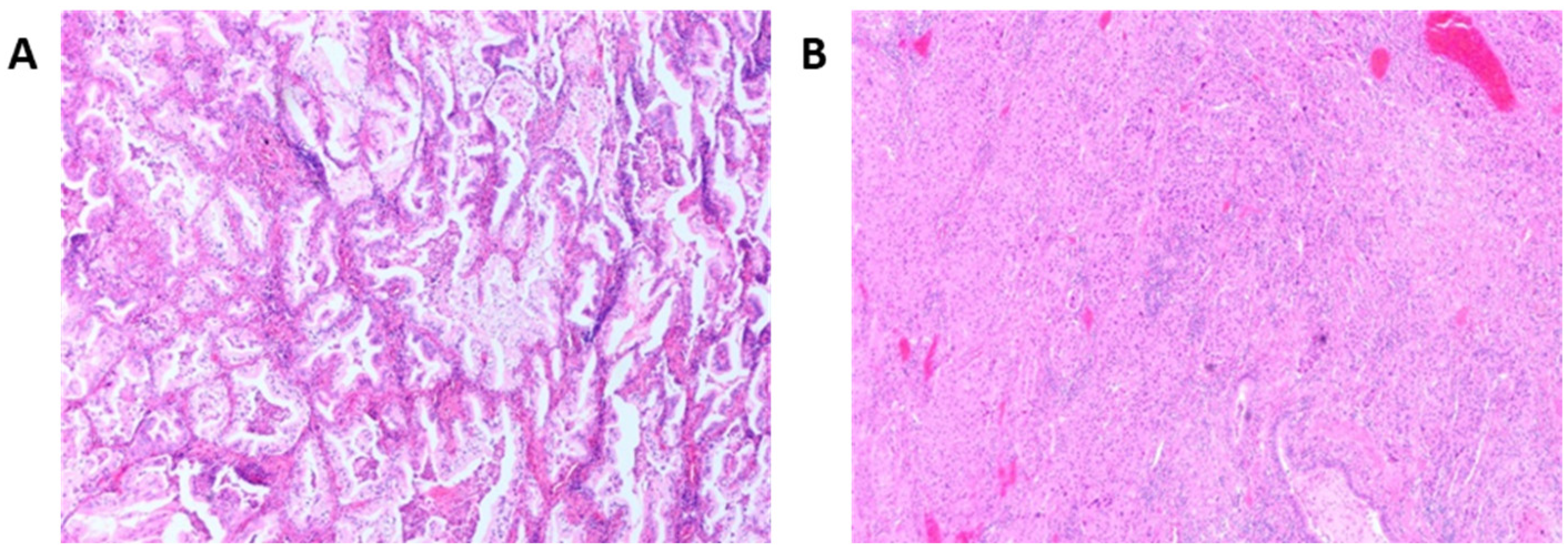 Cancers 15 01635 g003