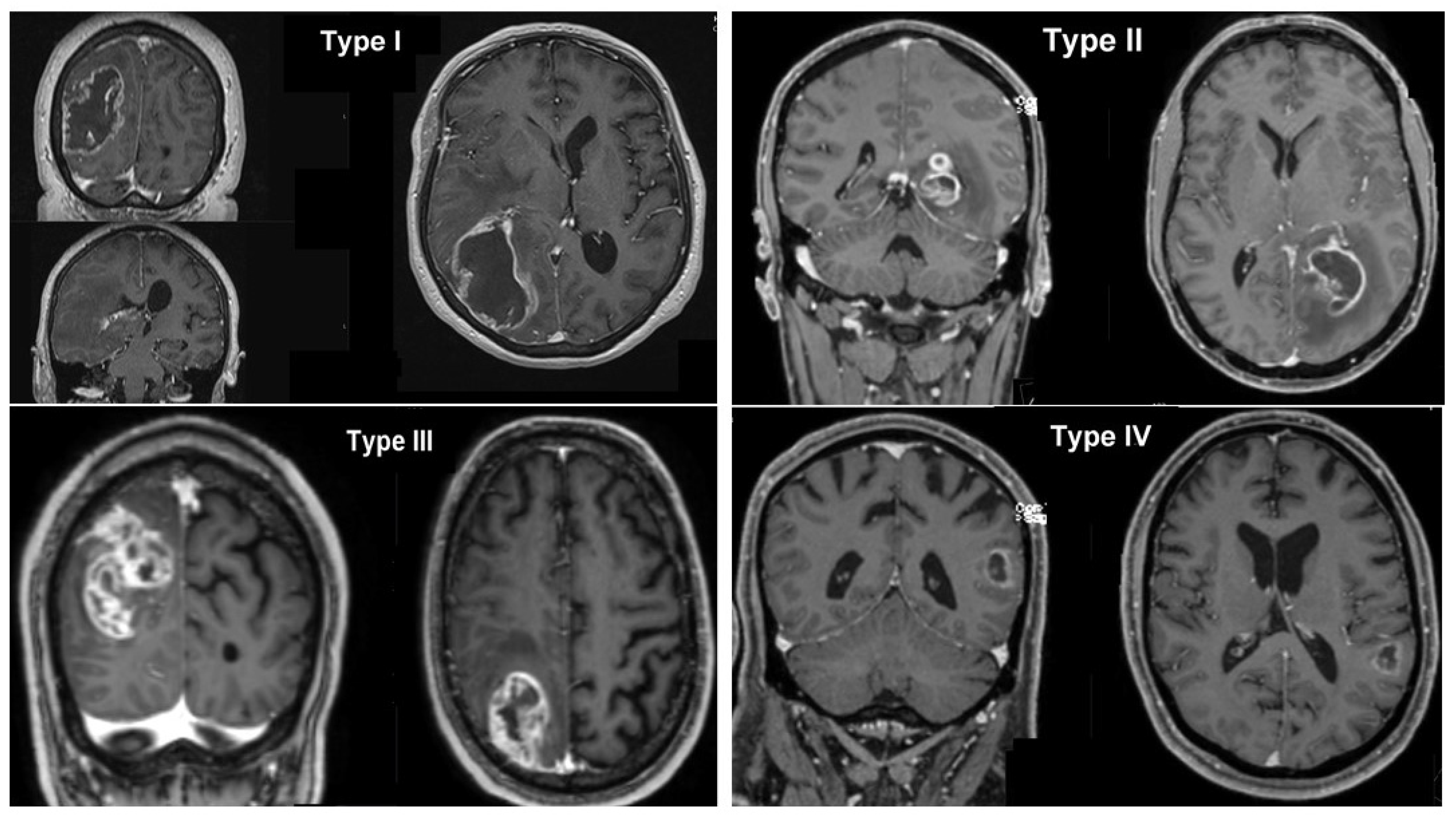 Cancers 15 01677 g002