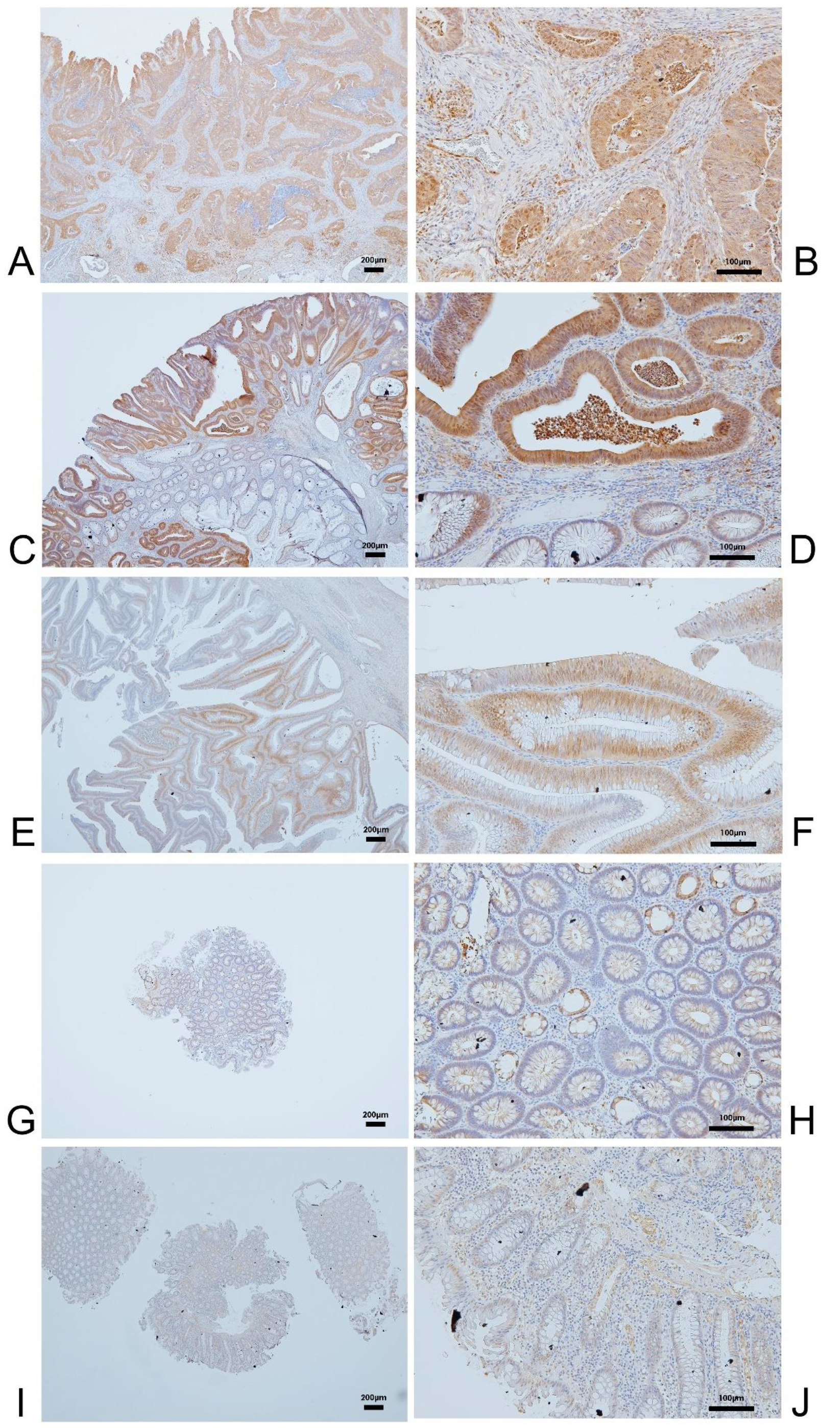 Cancers 15 01702 g003 Cancers 15 01702 g003