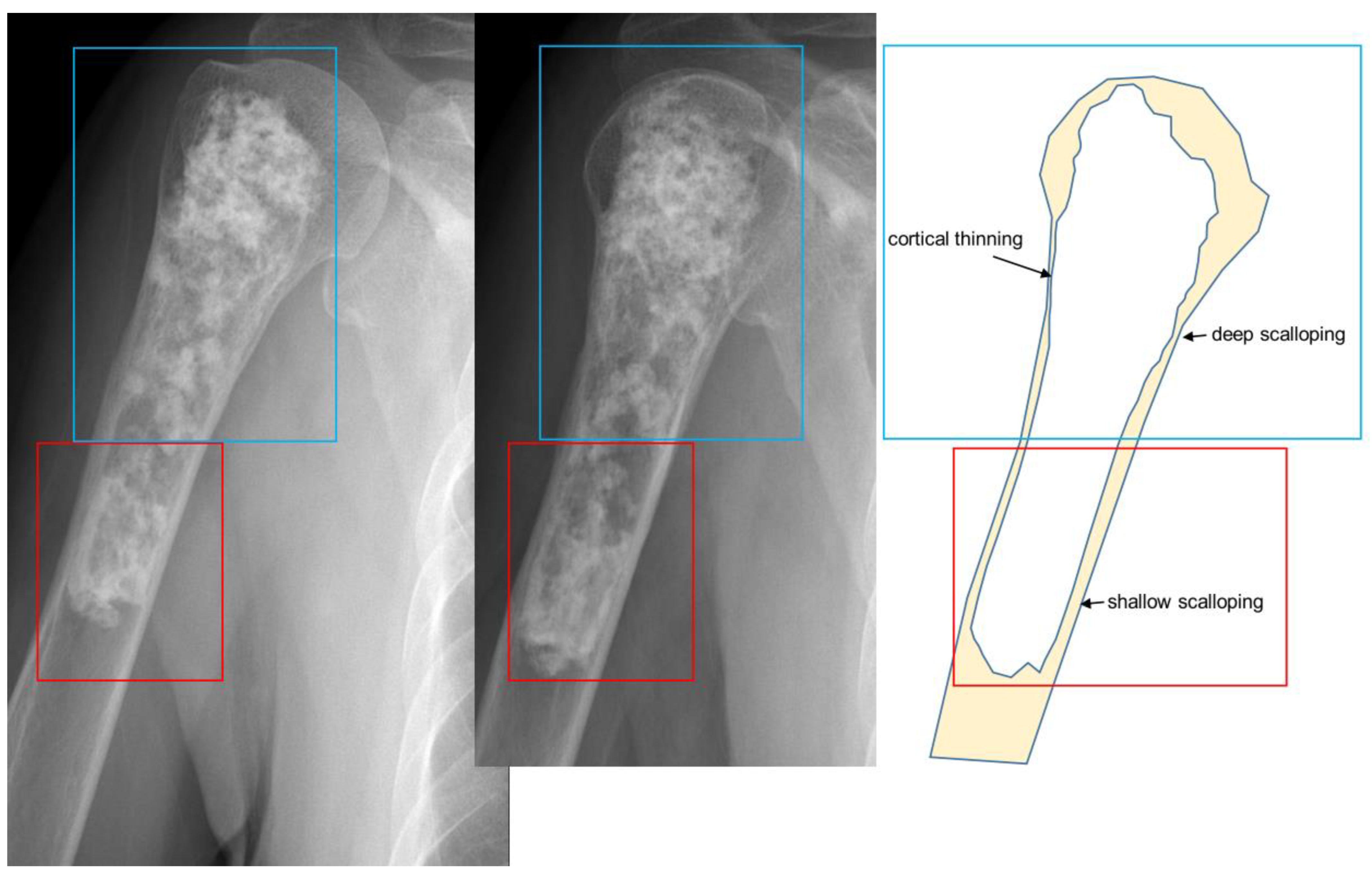 Cancers 15 01703 g010 Cancers 15 01703 g010
