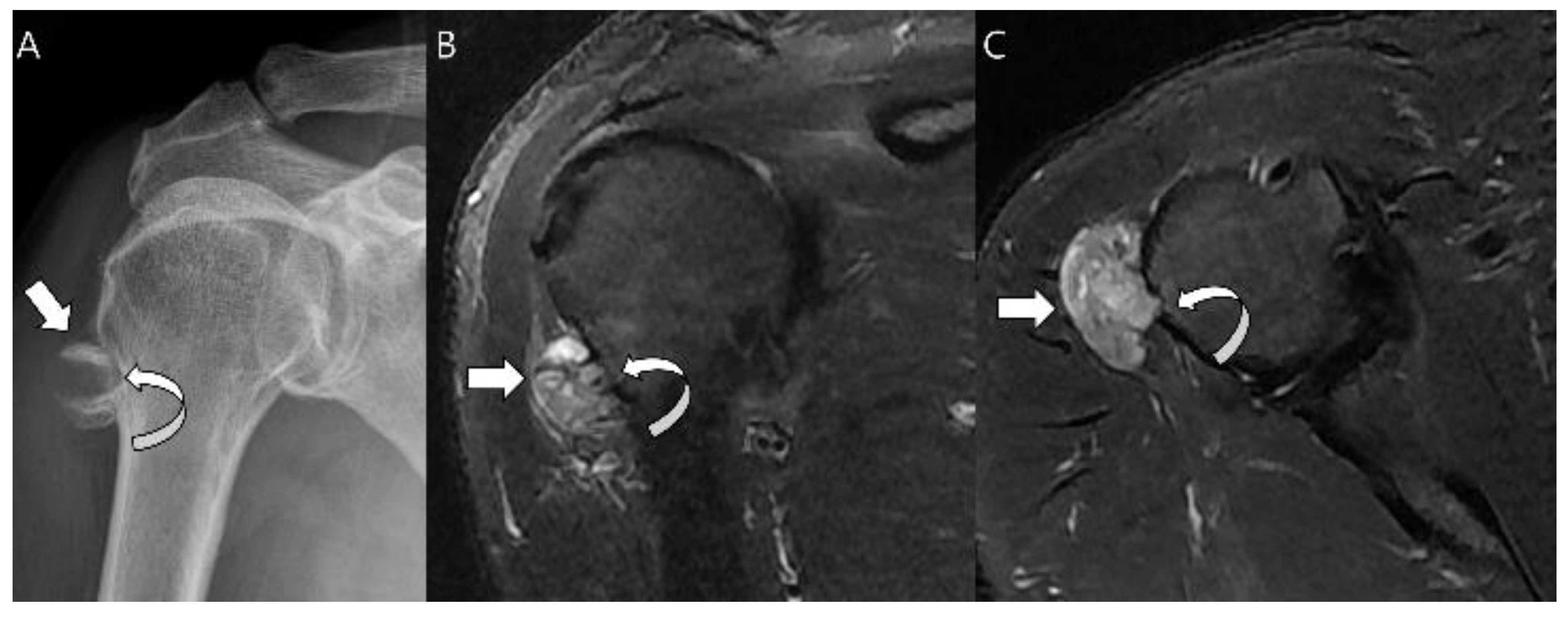 Cancers 15 01703 g011 Cancers 15 01703 g011