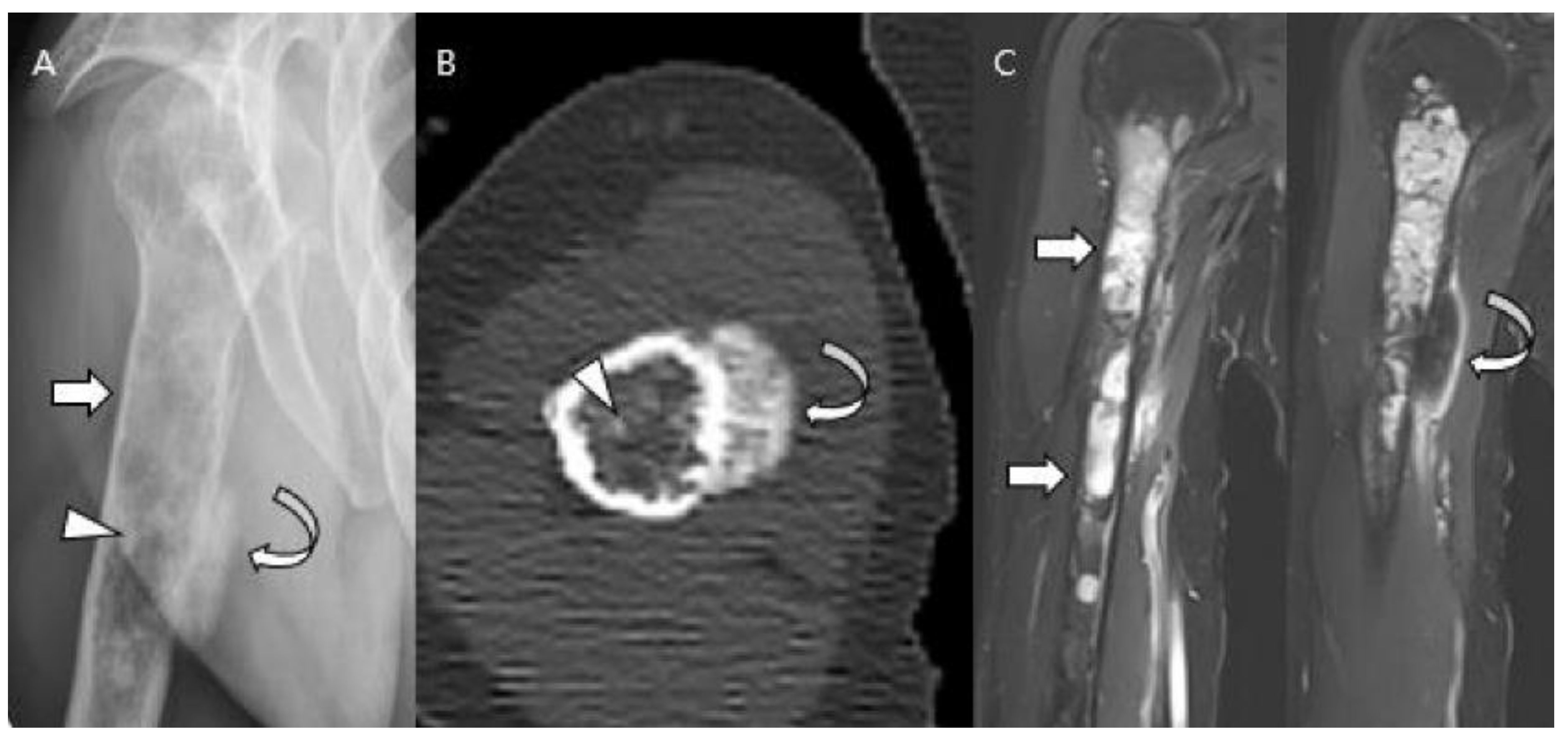 Cancers 15 01703 g013 Cancers 15 01703 g013