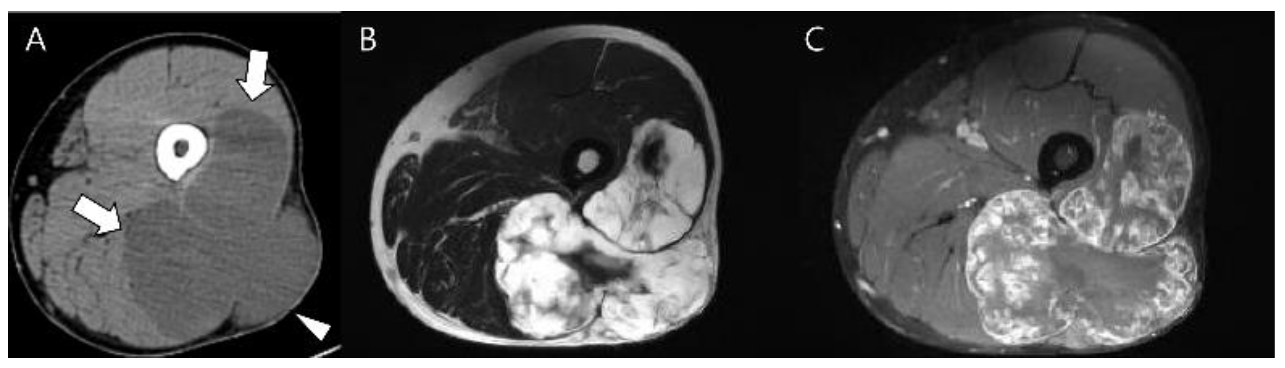 Cancers 15 01703 g014 Cancers 15 01703 g014