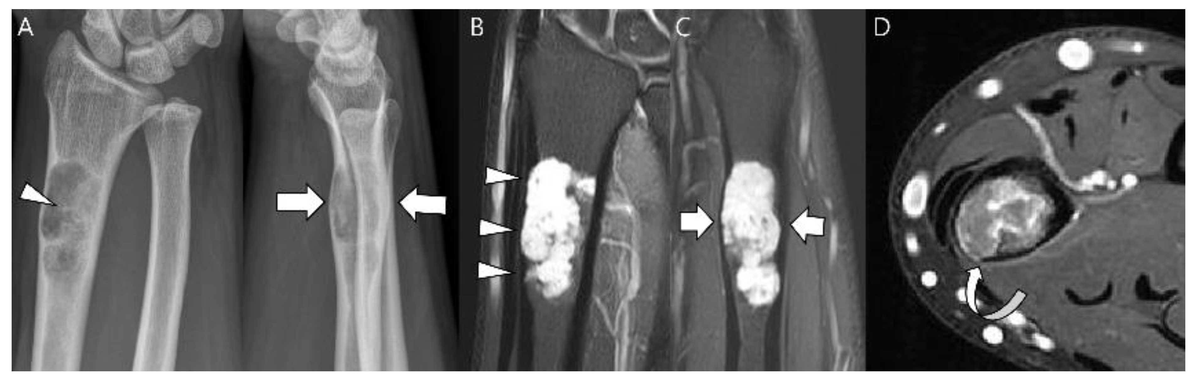 Cancers 15 01703 g017 Cancers 15 01703 g017