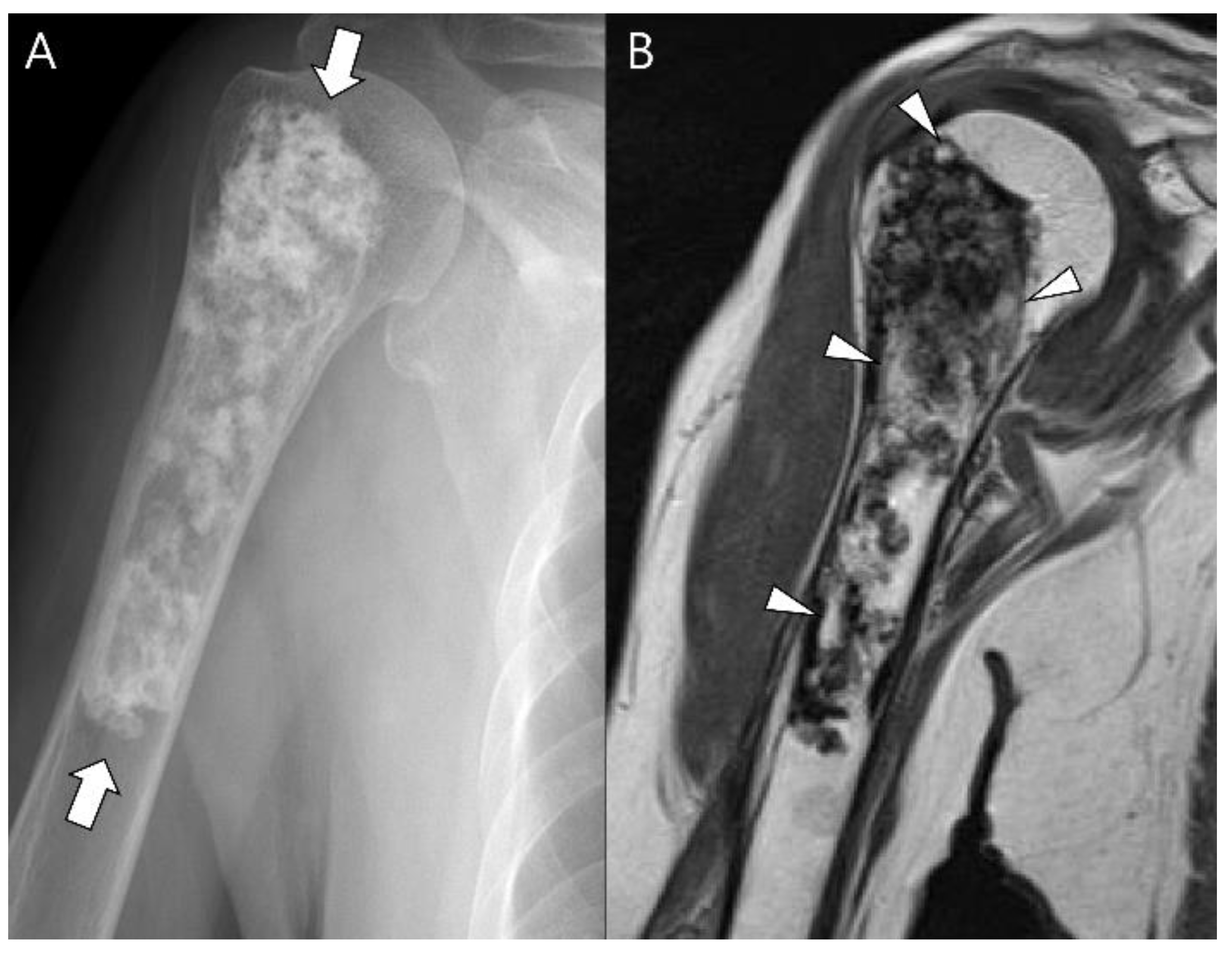 Cancers 15 01703 g019 Cancers 15 01703 g019