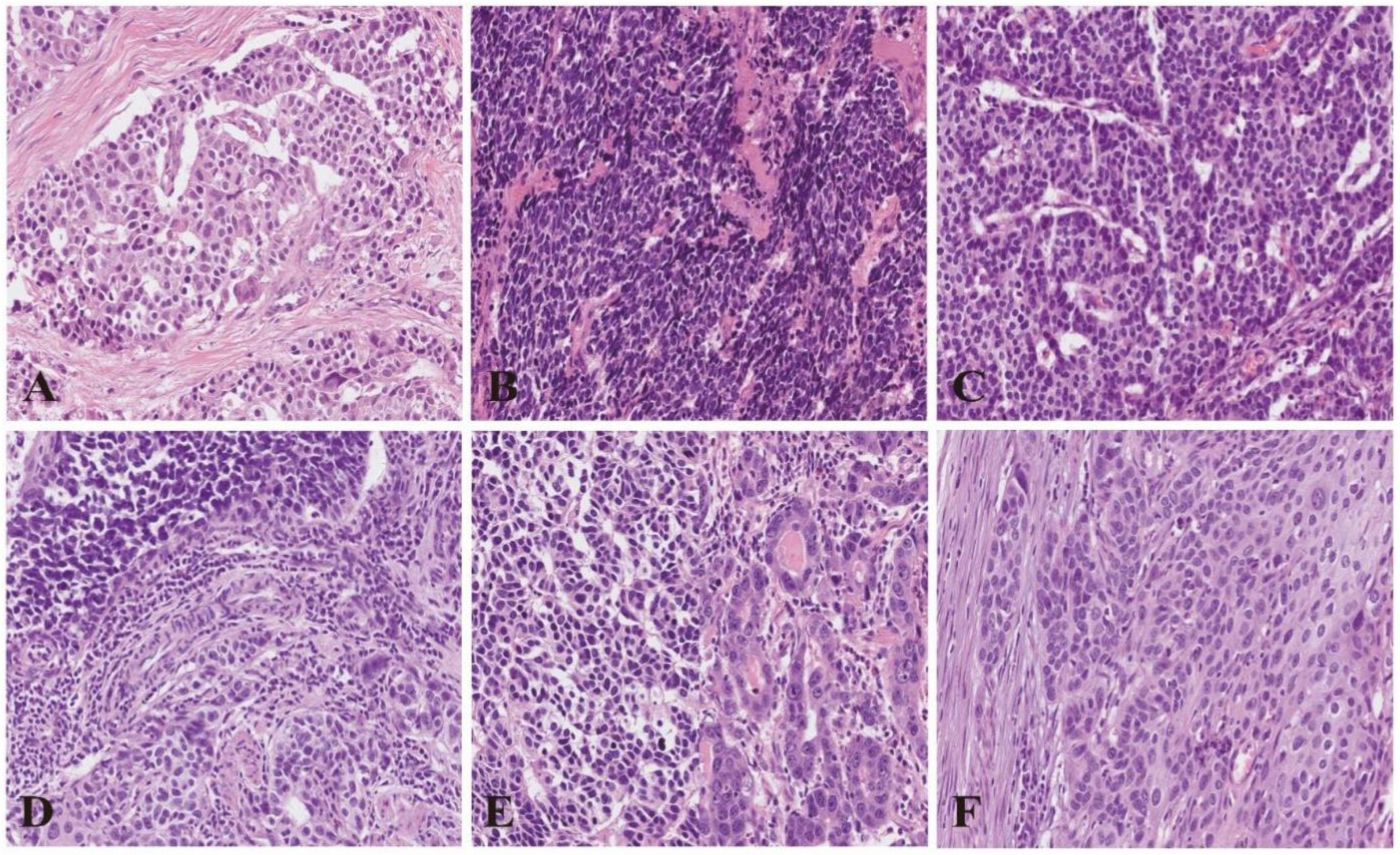 Cancers 15 01732 g003