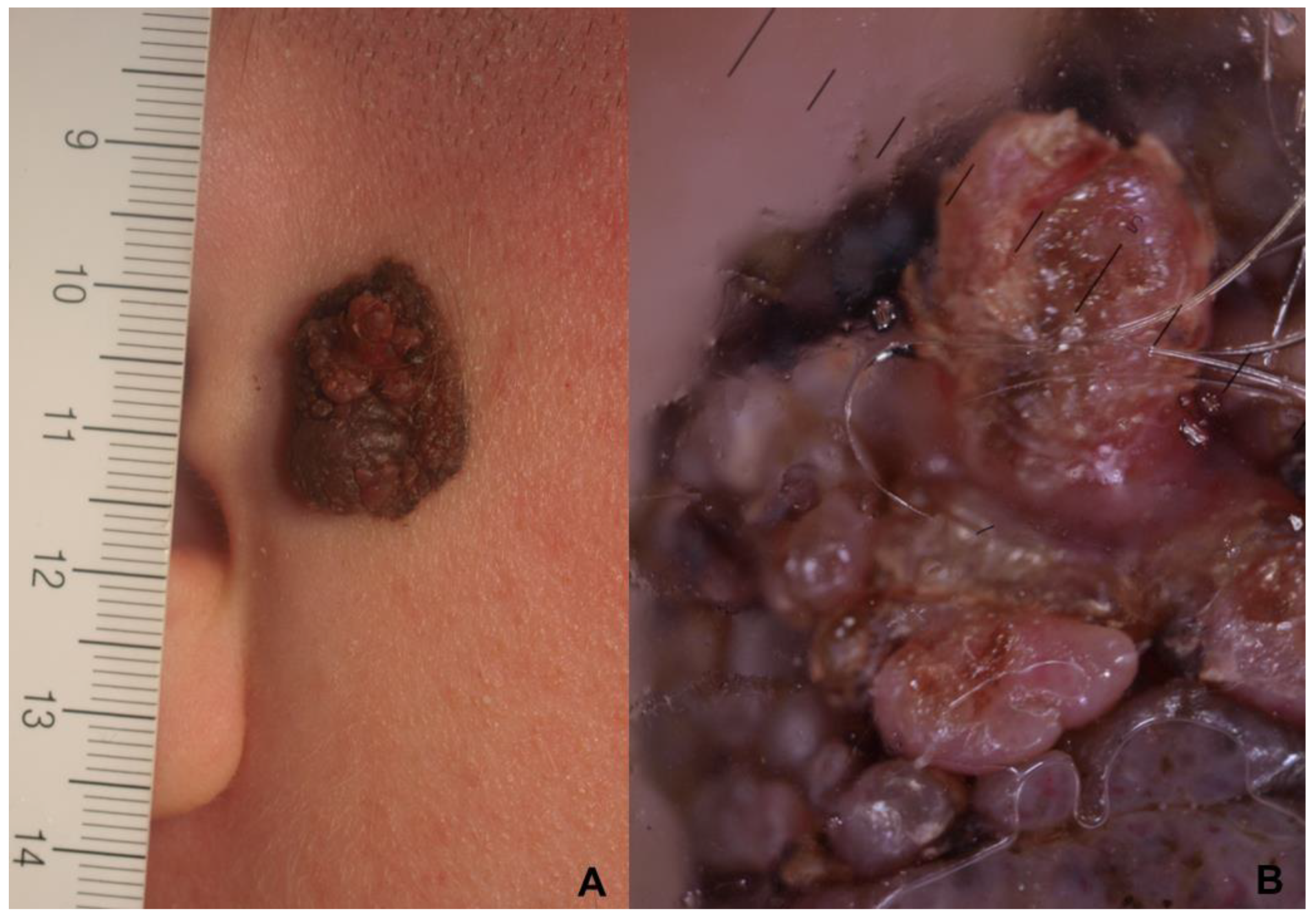 Cancers 15 01835 g003