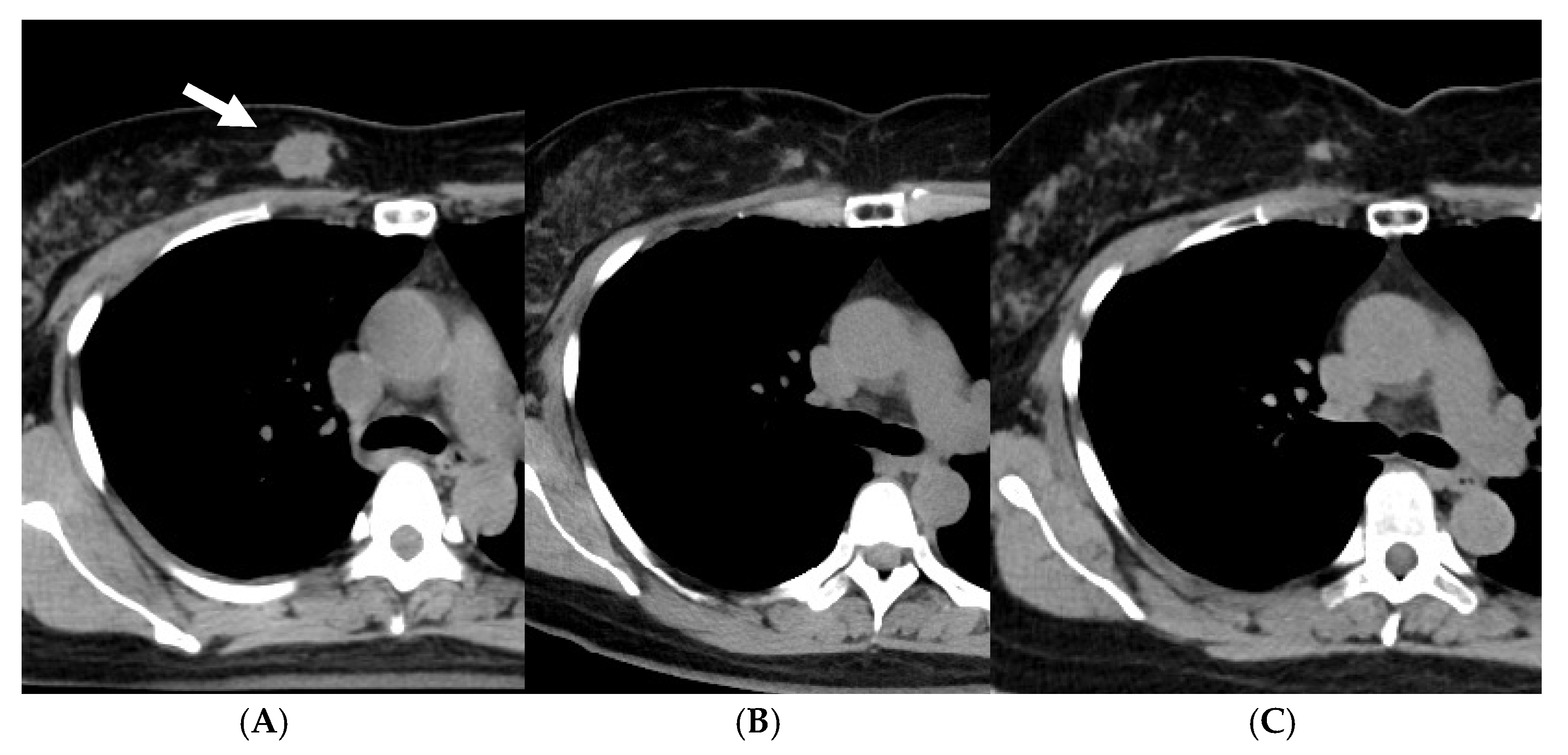 Cancers 15 01864 g002