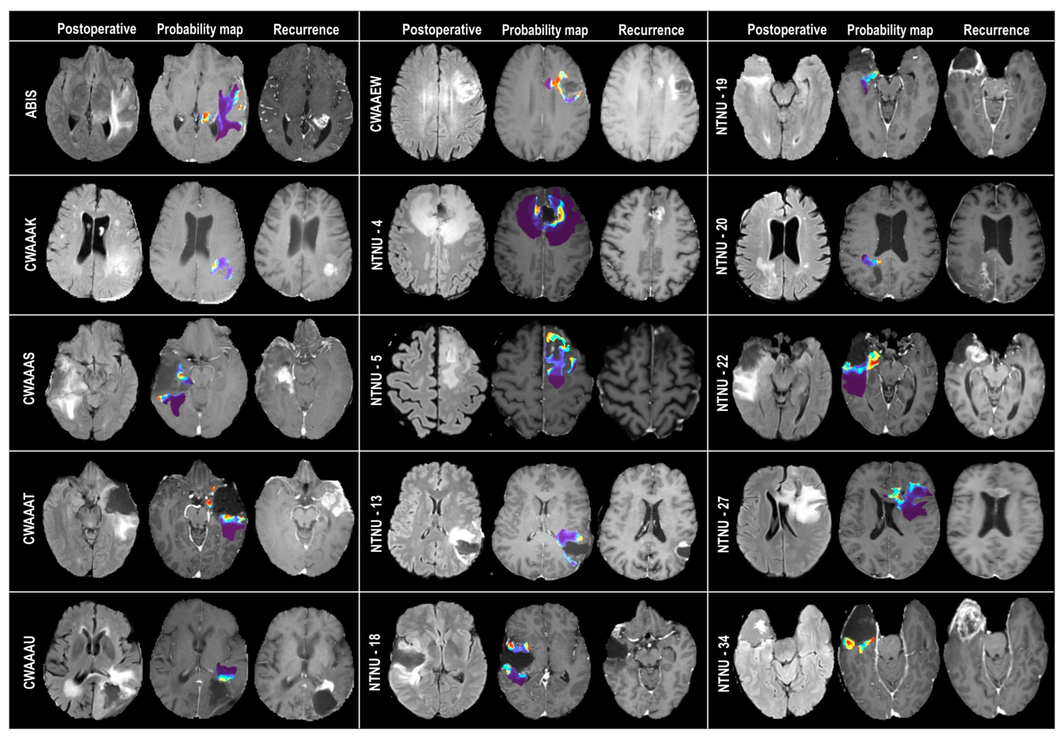 Cancers 15 01894 g005