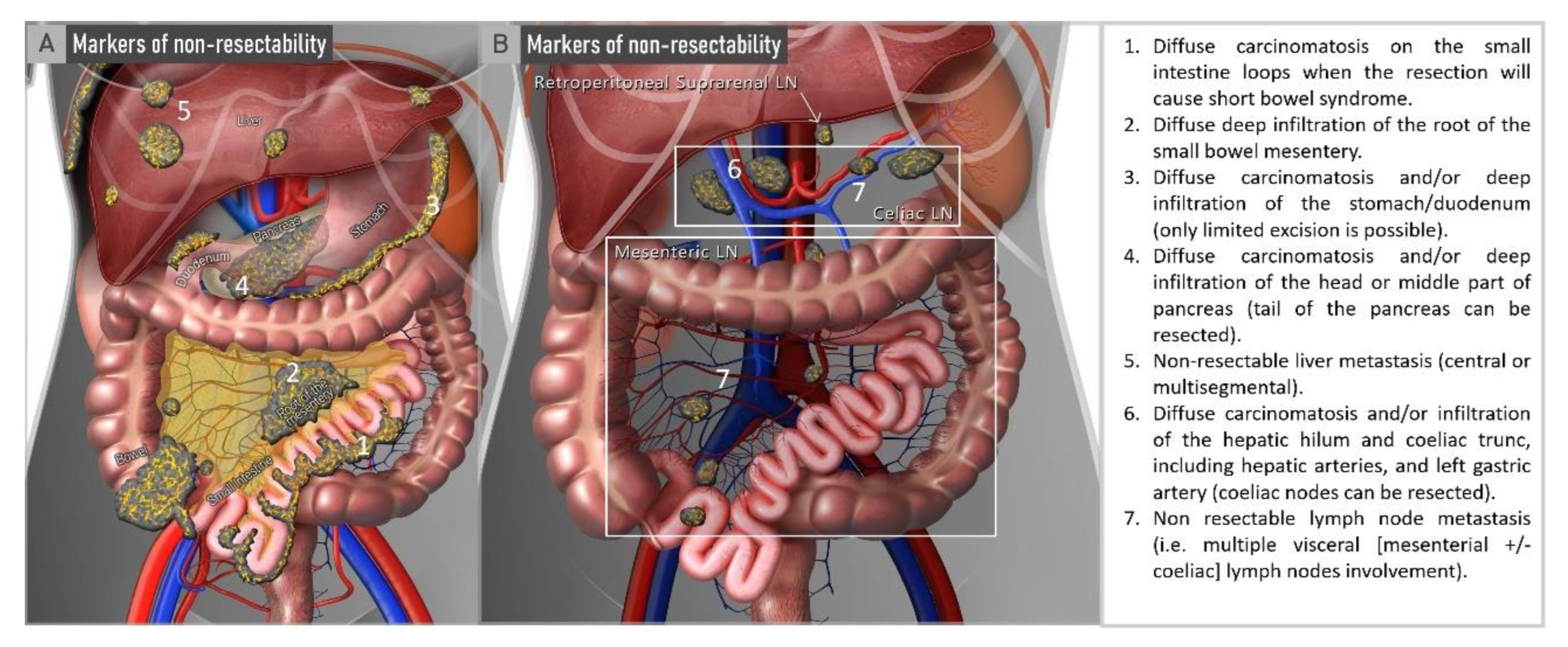 Cancers 15 01904 g002