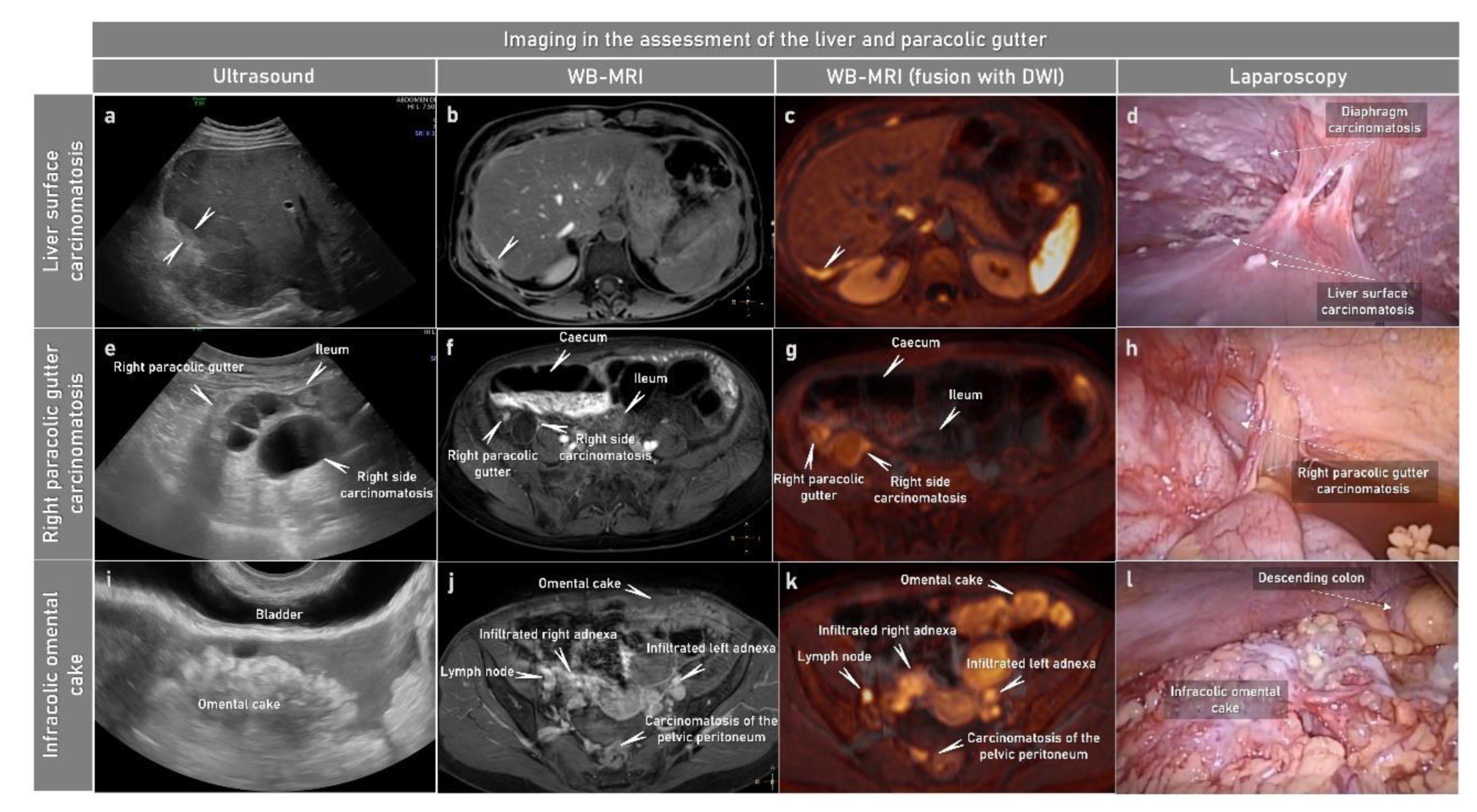 Cancers 15 01904 g004