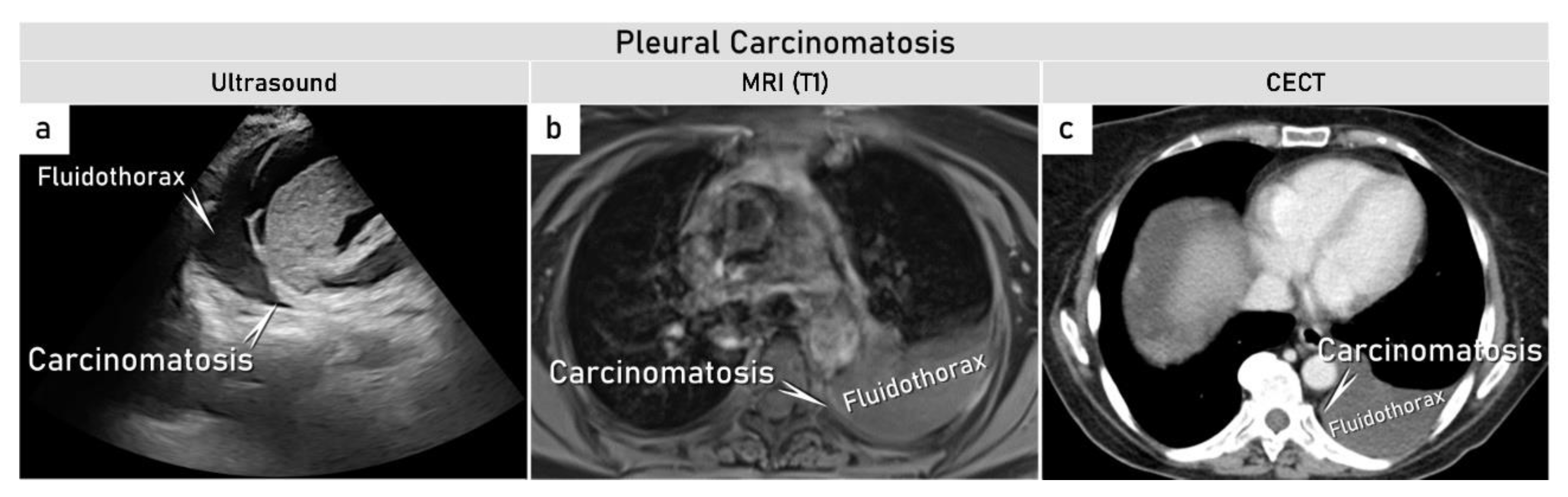 Cancers 15 01904 g005