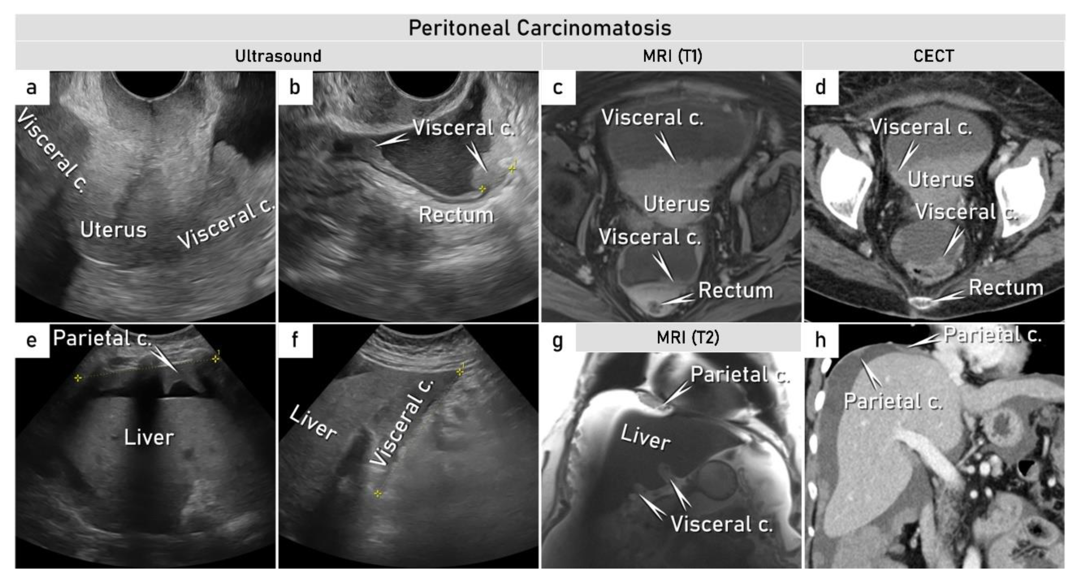Cancers 15 01904 g007