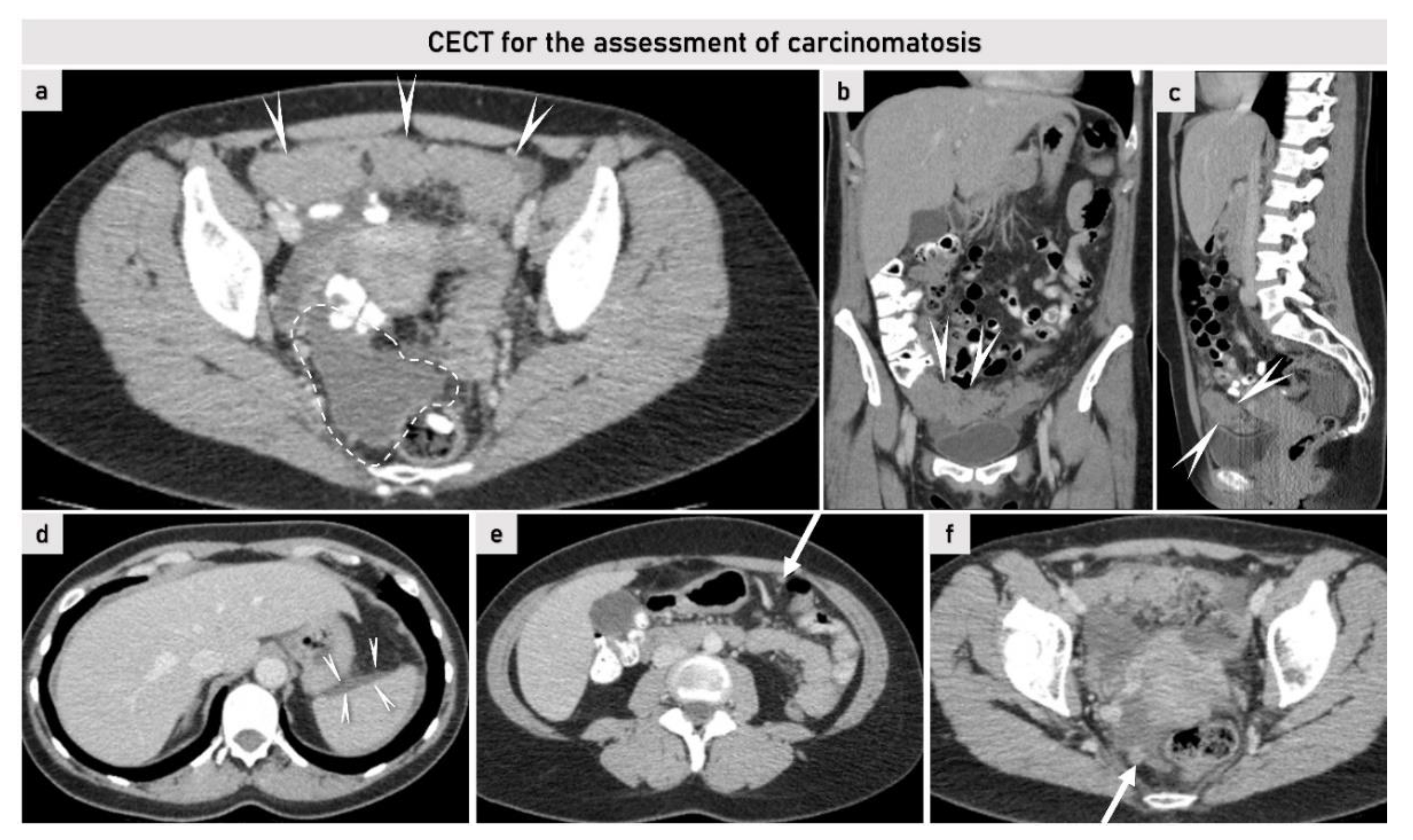 Cancers 15 01904 g008