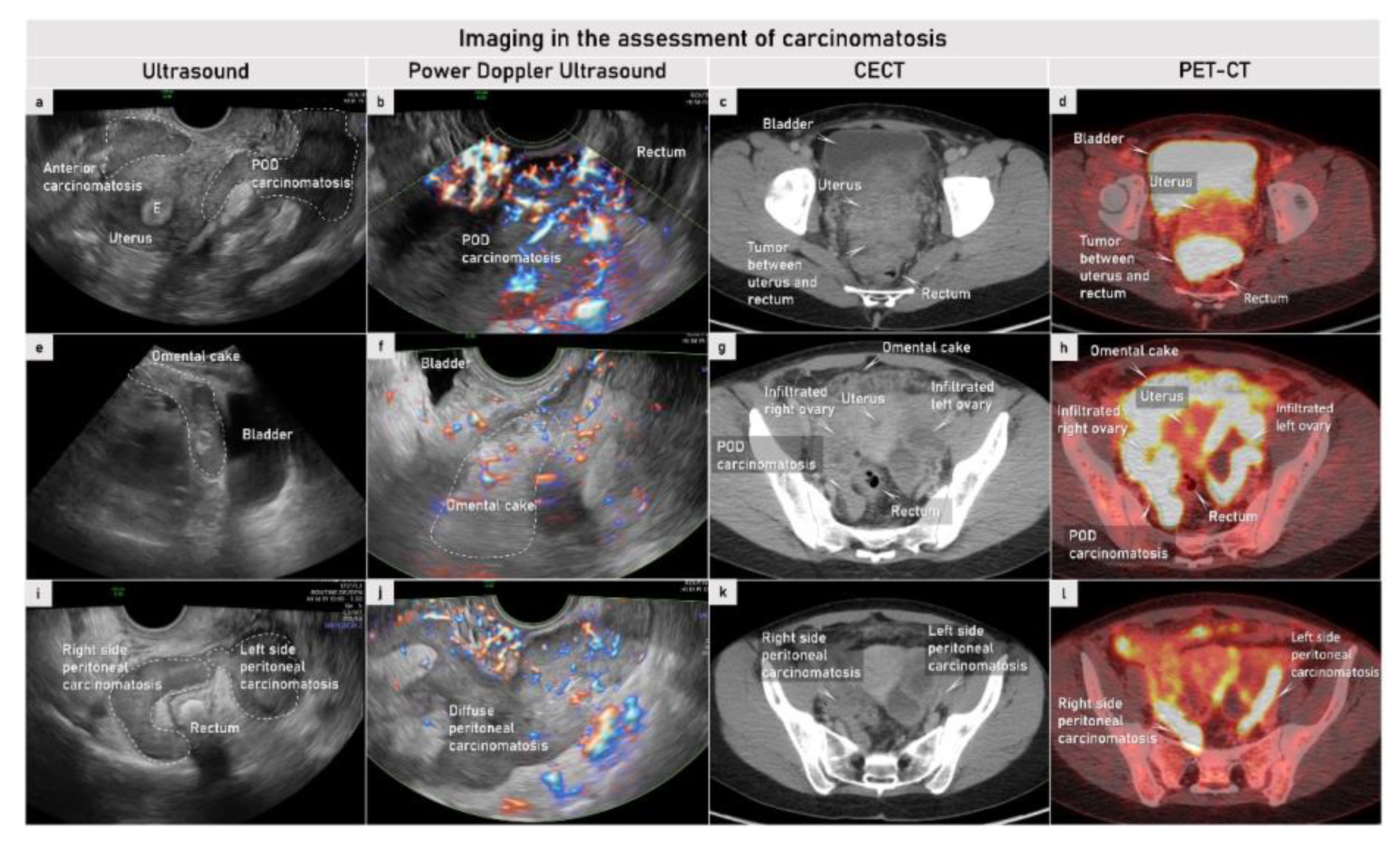 Cancers 15 01904 g009