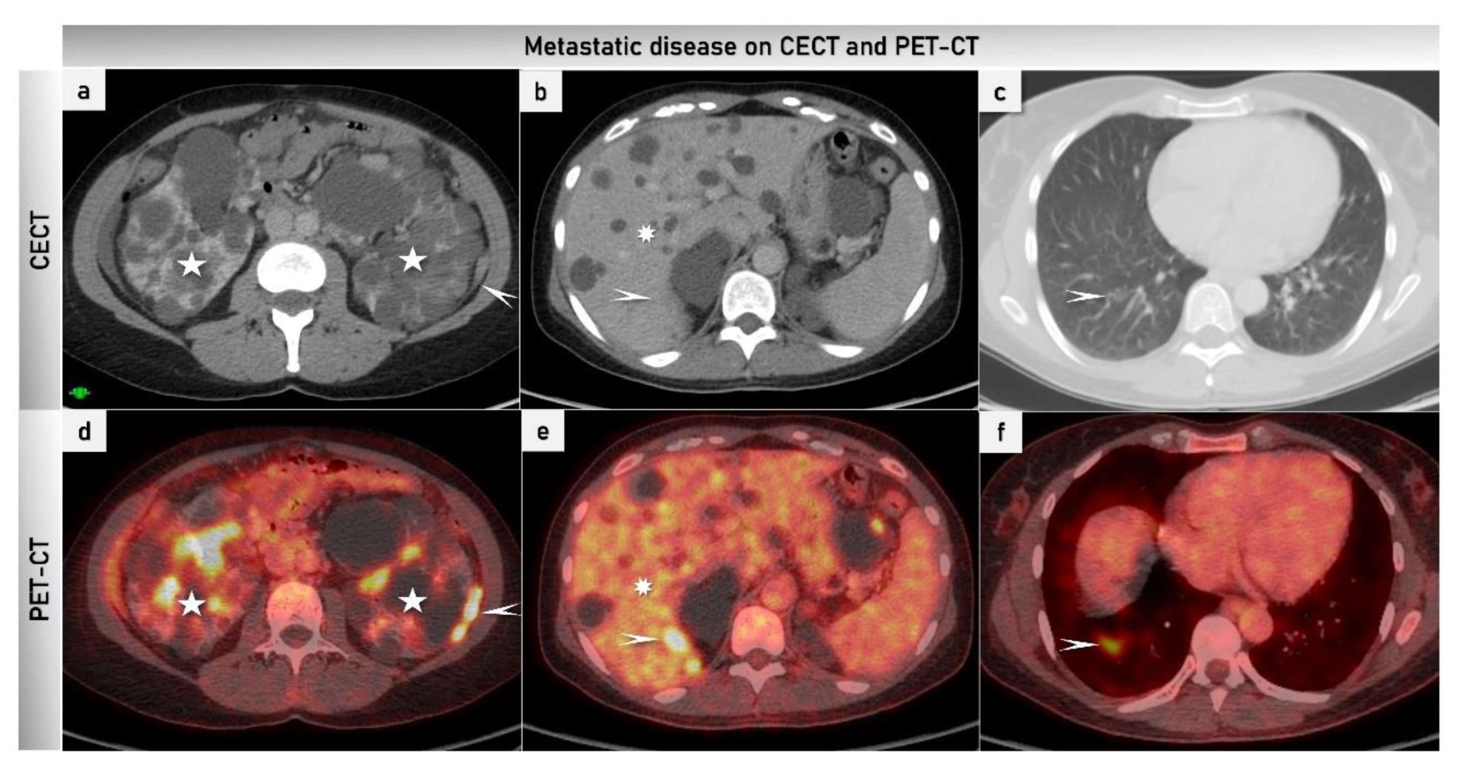 Cancers 15 01904 g010