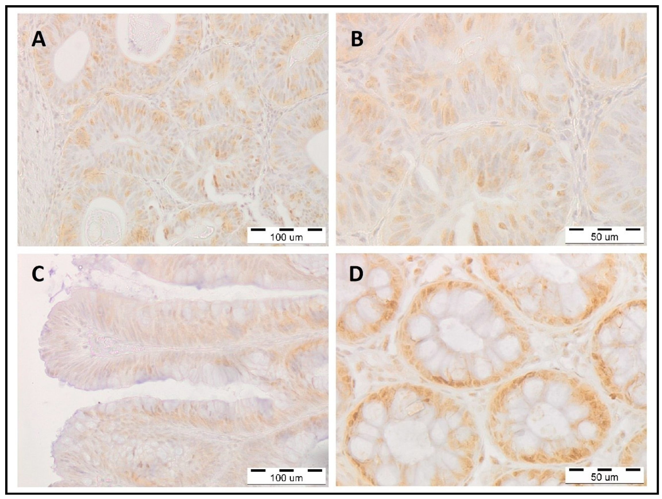 Cancers 15 01905 g002