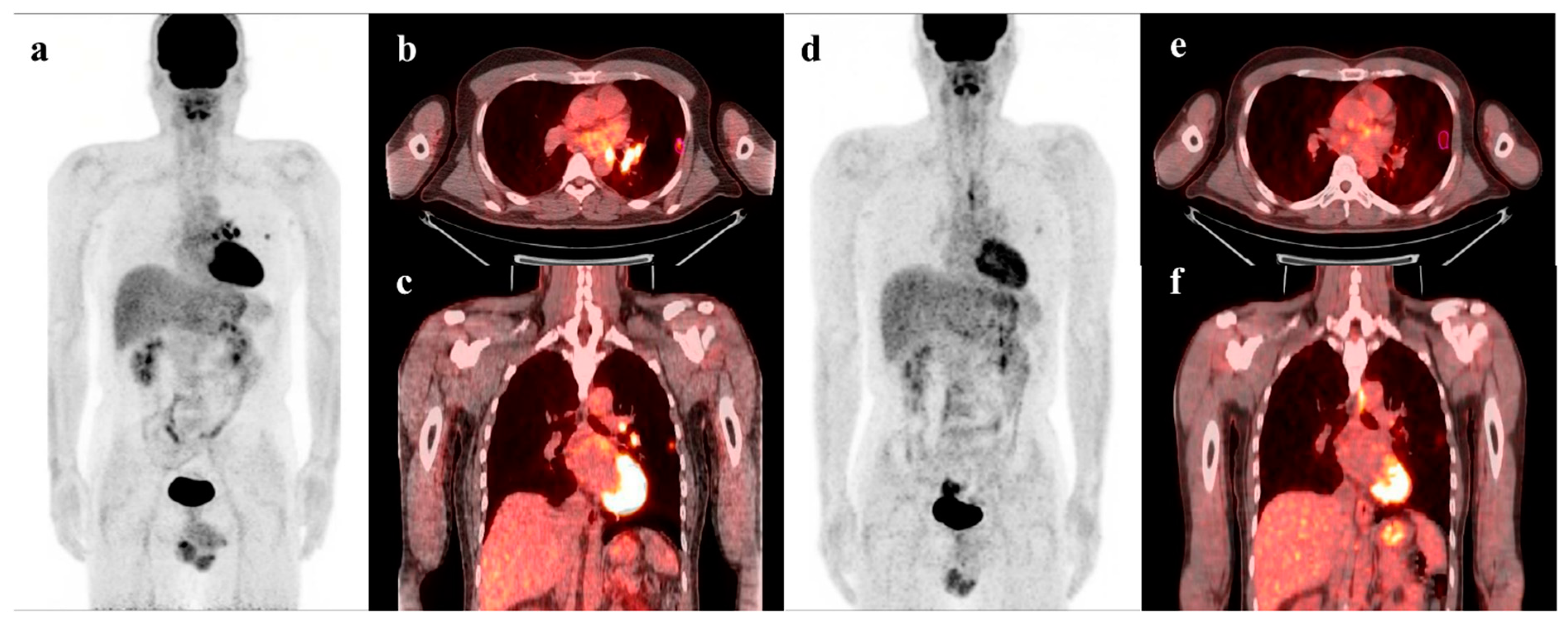 Cancers 15 02012 g005