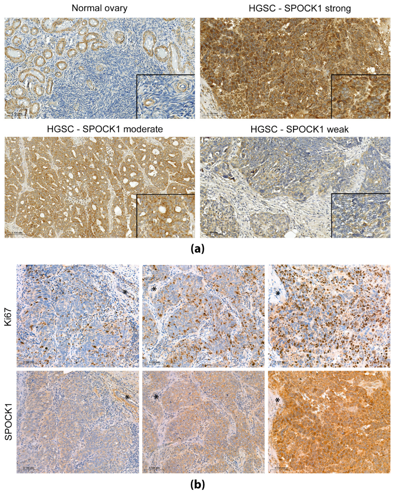 Cancers 15 02037 g002