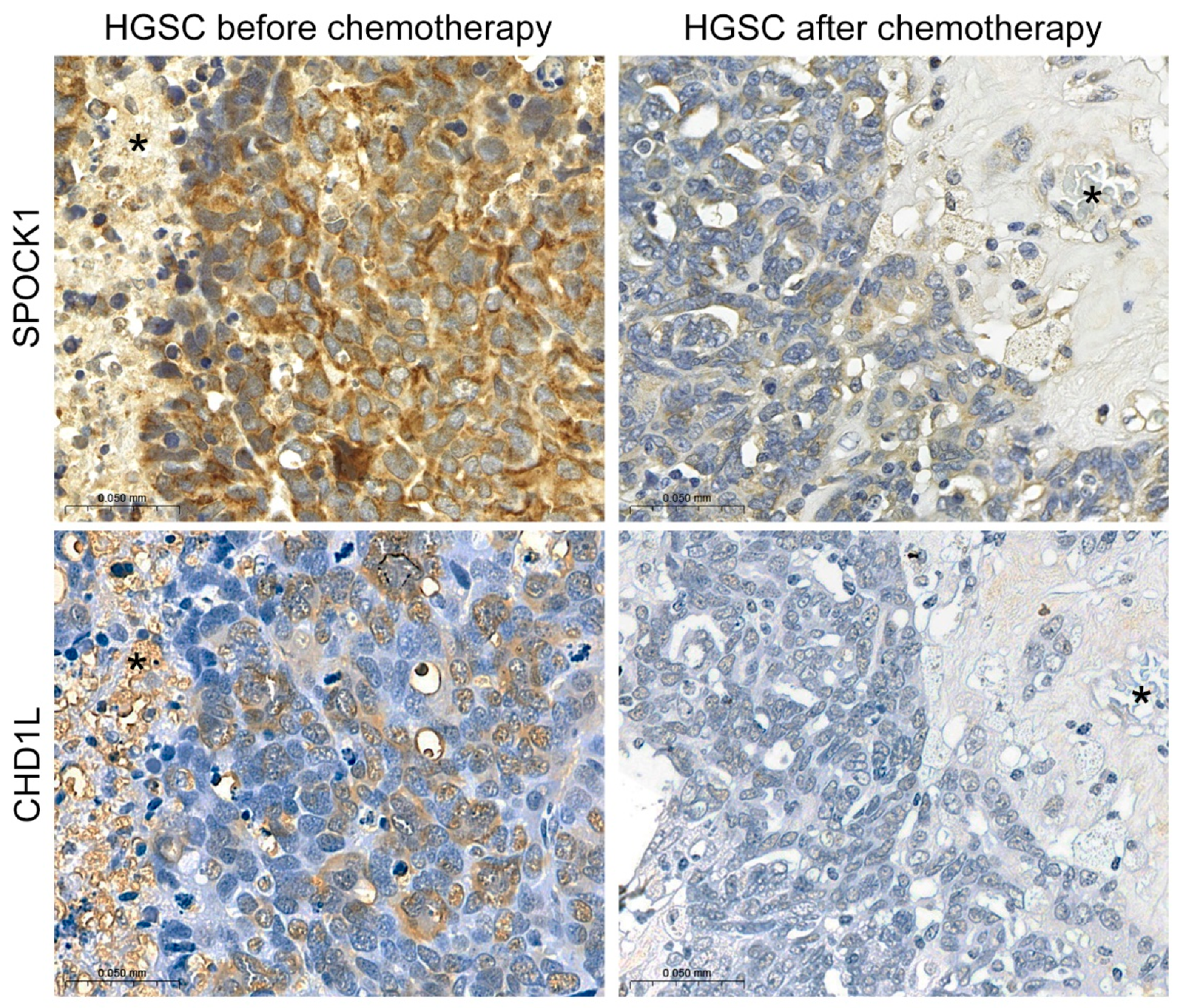 Cancers 15 02037 g009