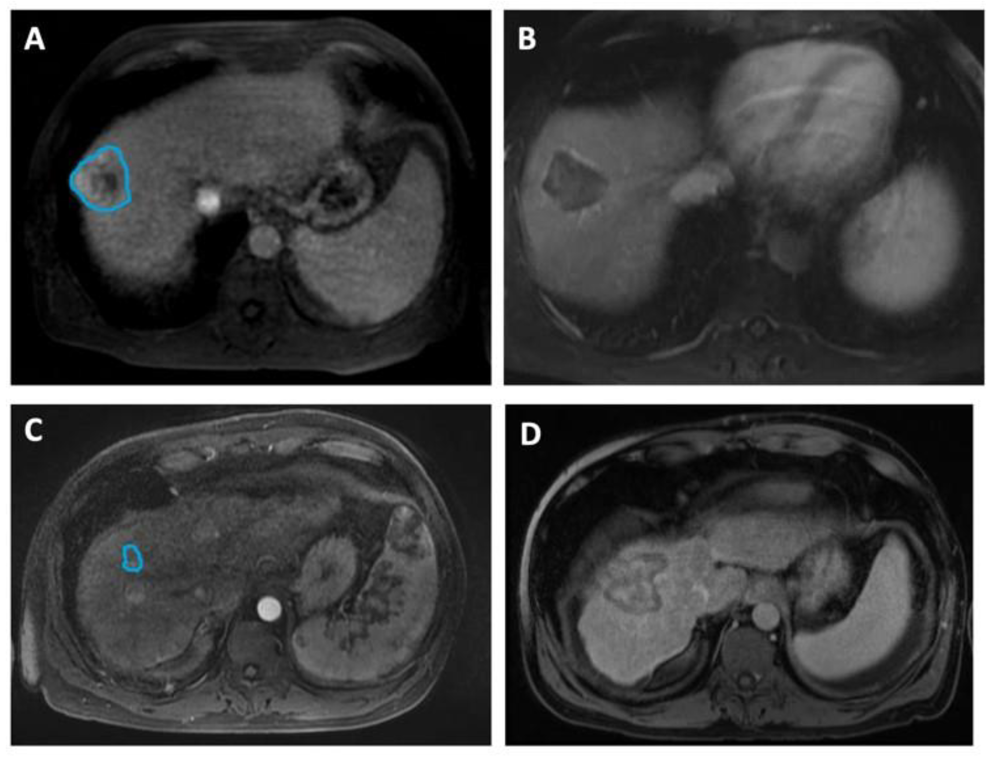 Cancers 15 02058 g002