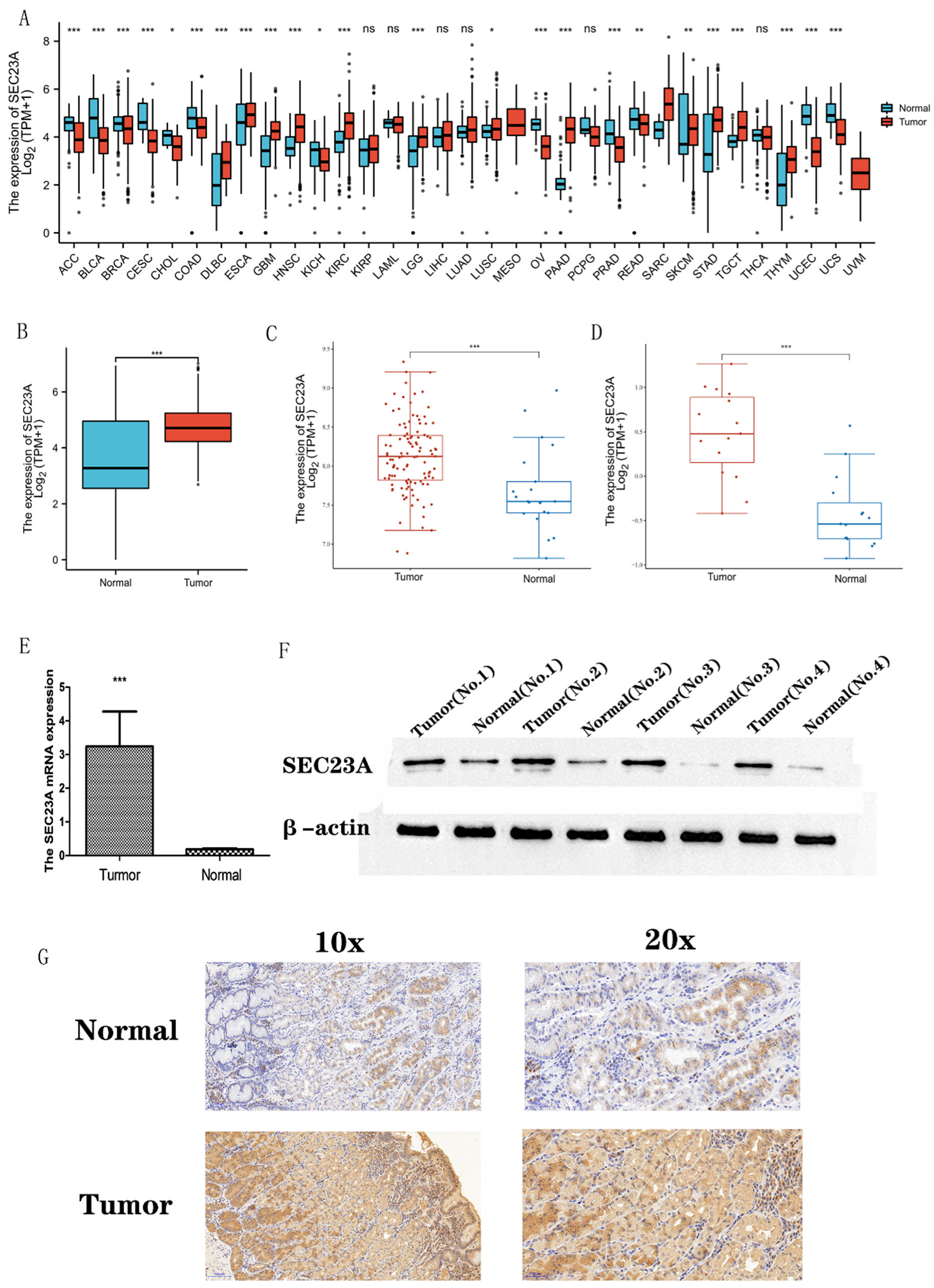 Cancers 15 02065 g001