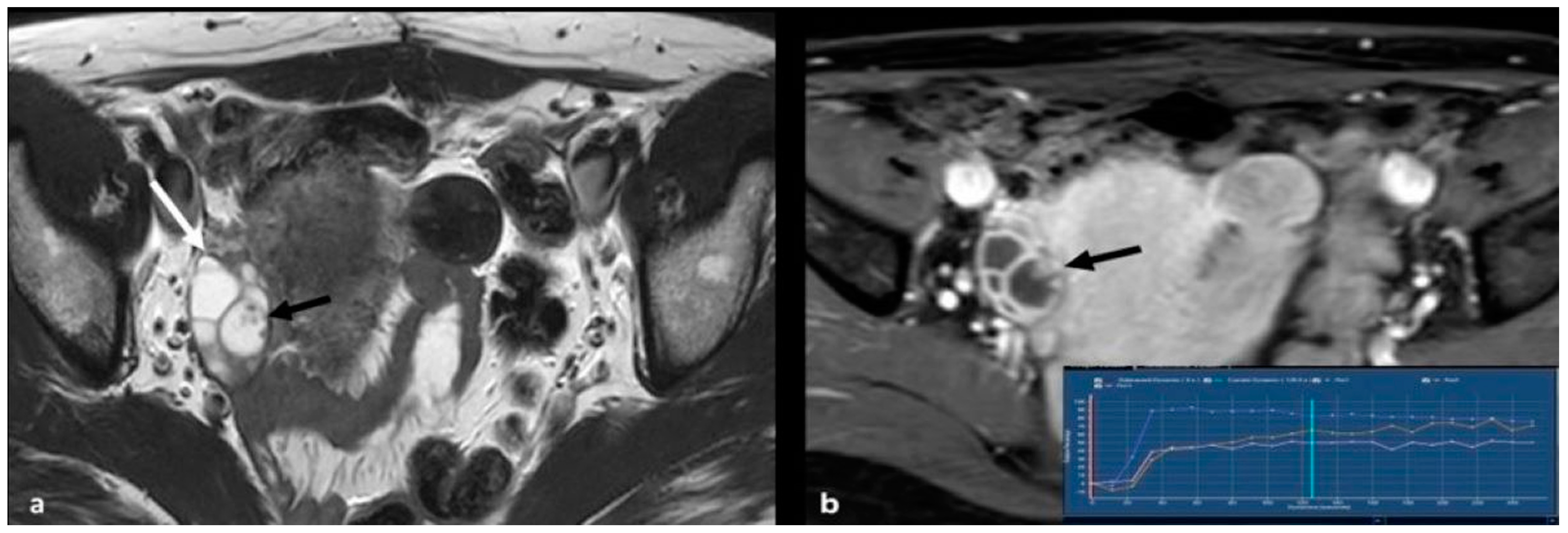 Cancers 15 02106 g005