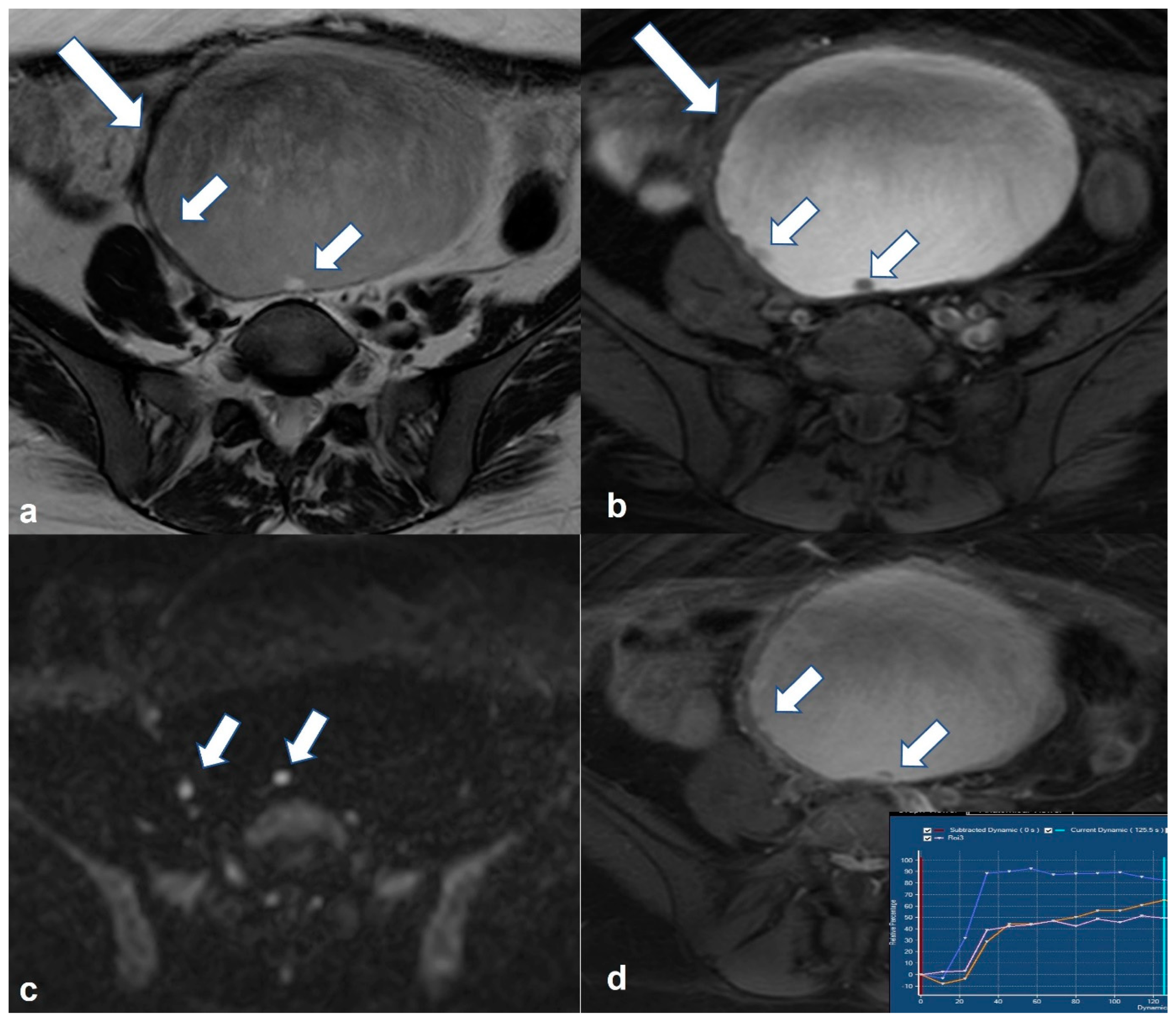 Cancers 15 02106 g007