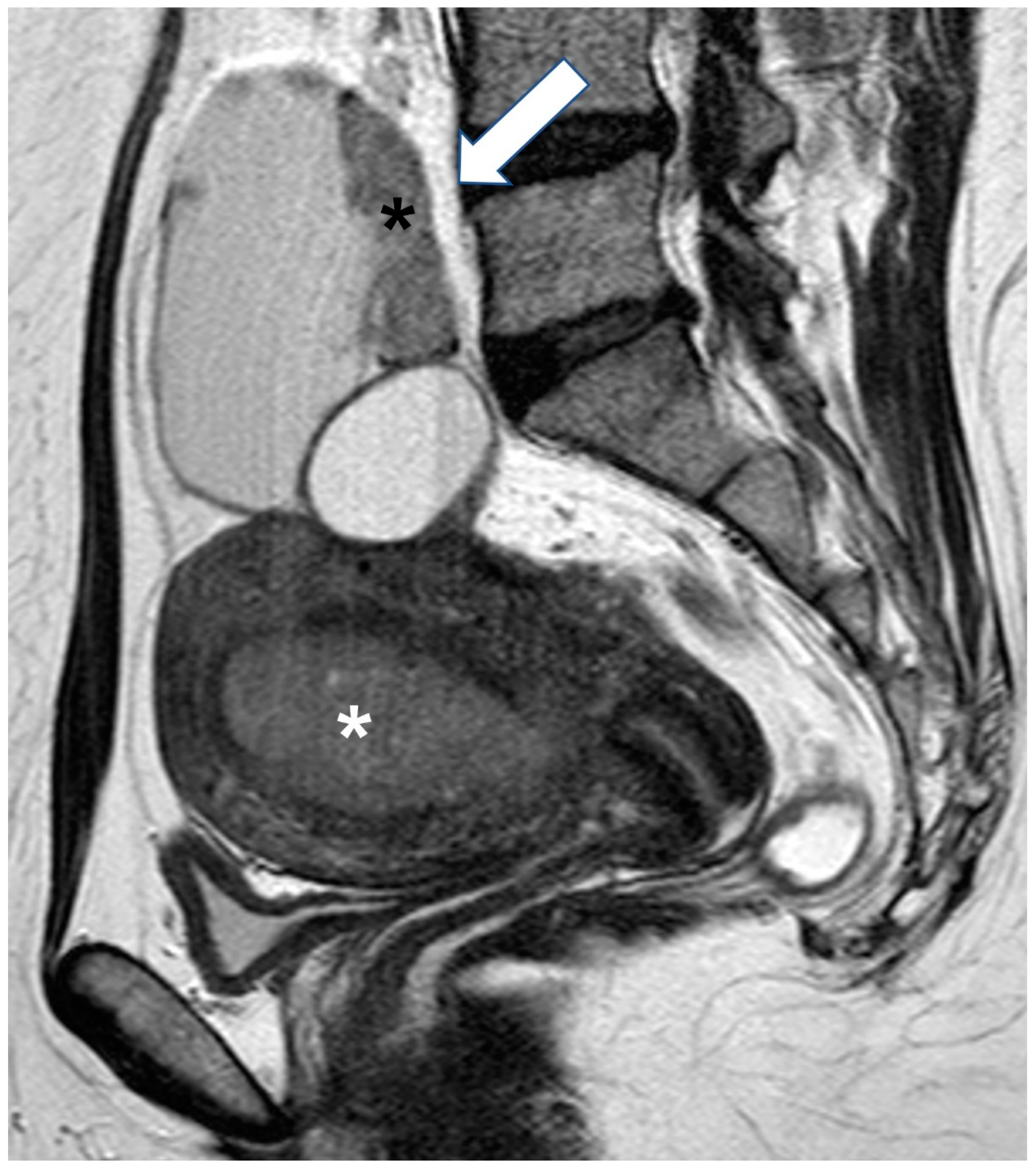 Cancers 15 02106 g008