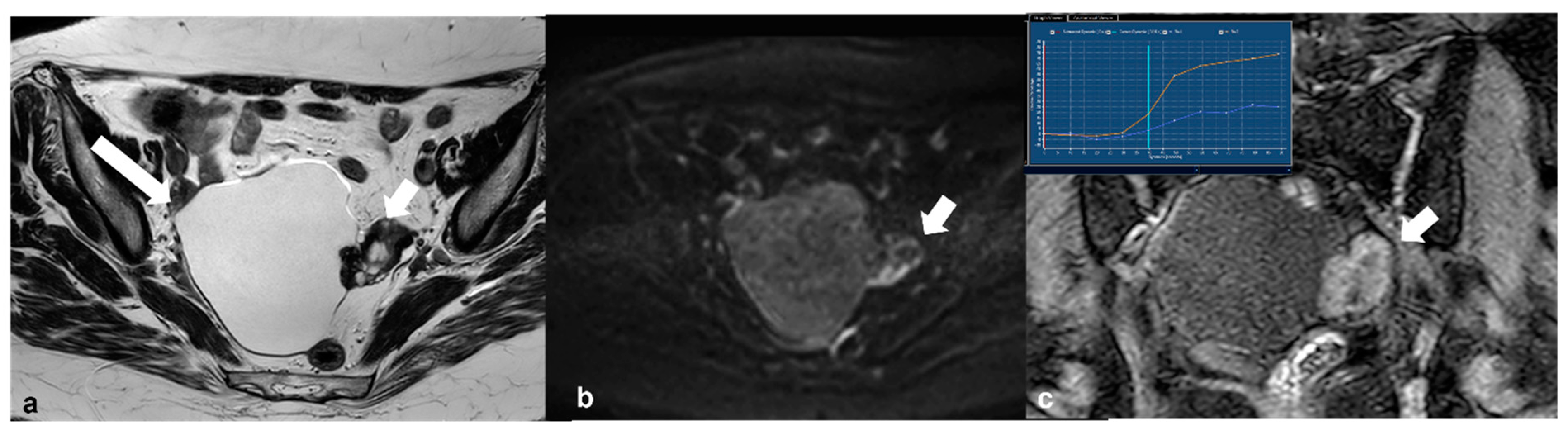 Cancers 15 02106 g009