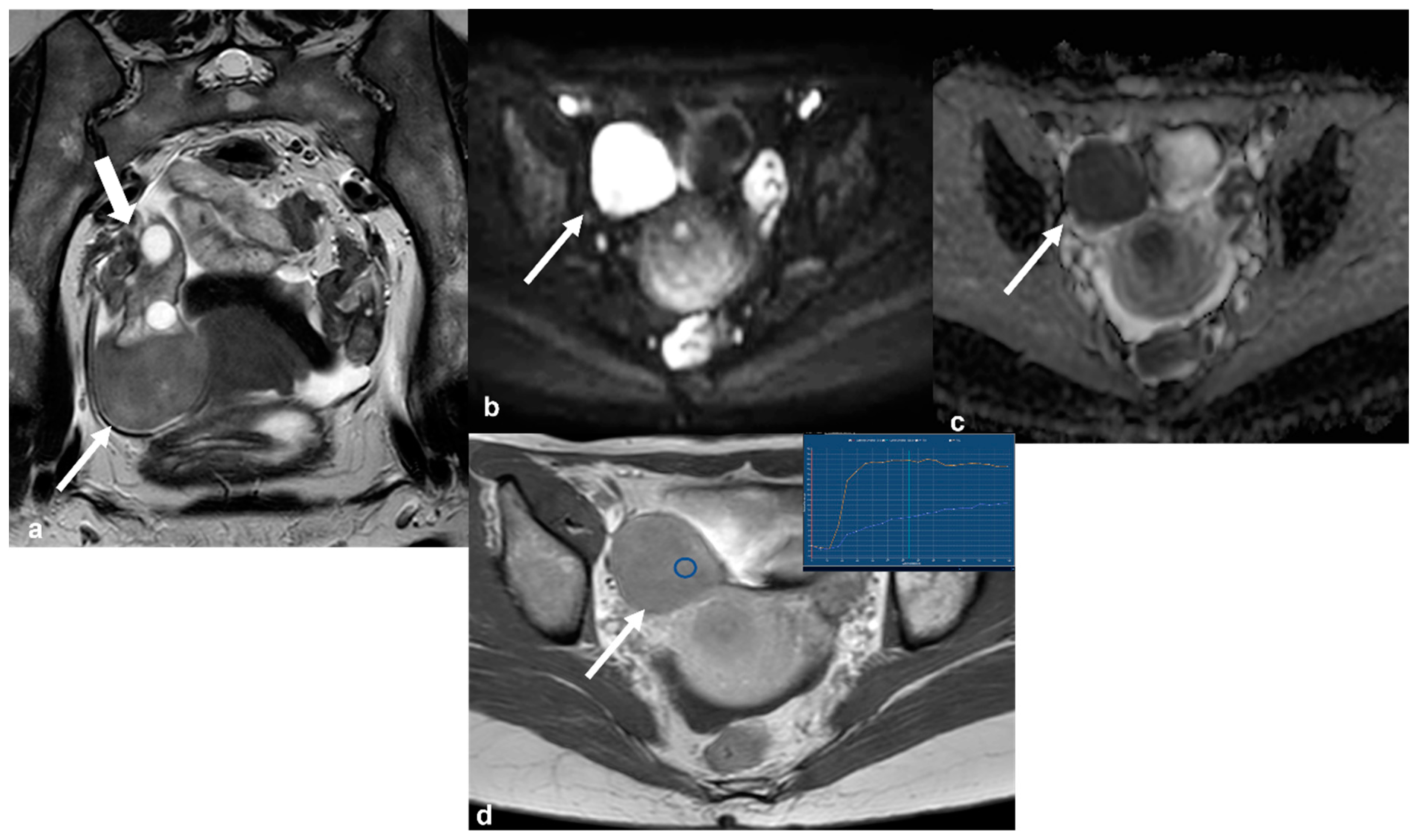 Cancers 15 02106 g010