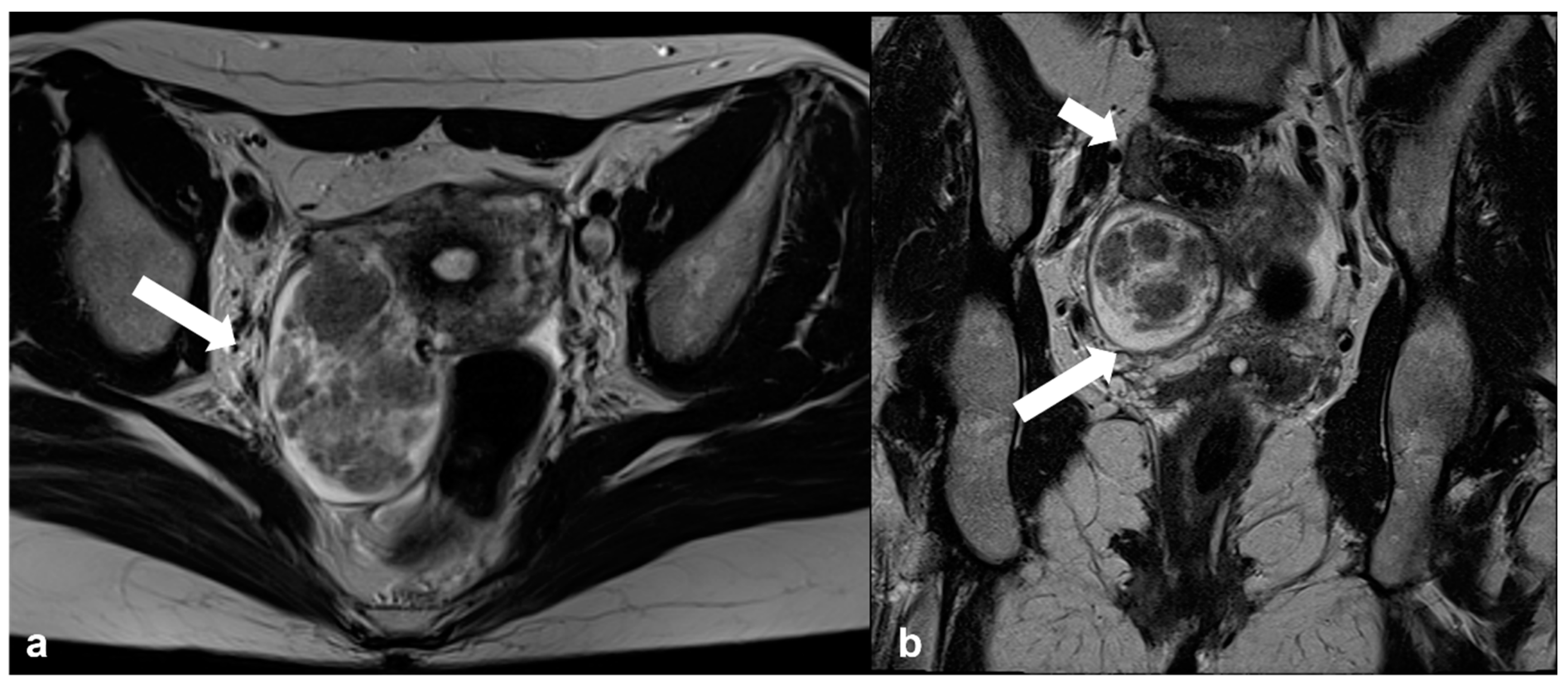 Cancers 15 02106 g011