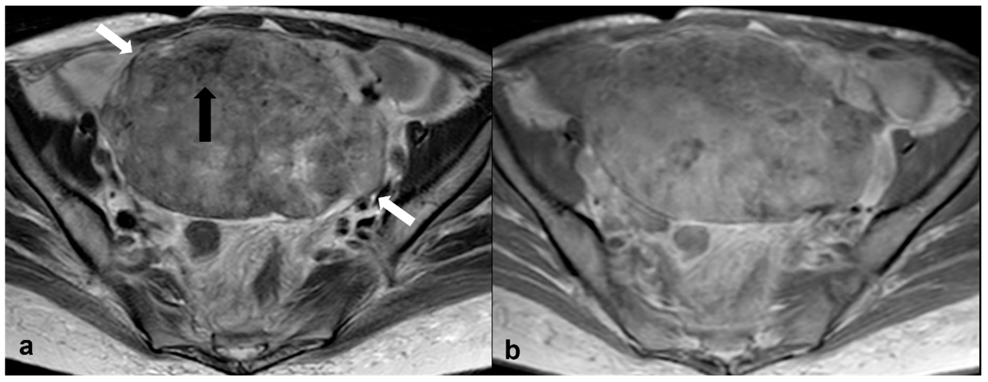 Cancers 15 02106 g013