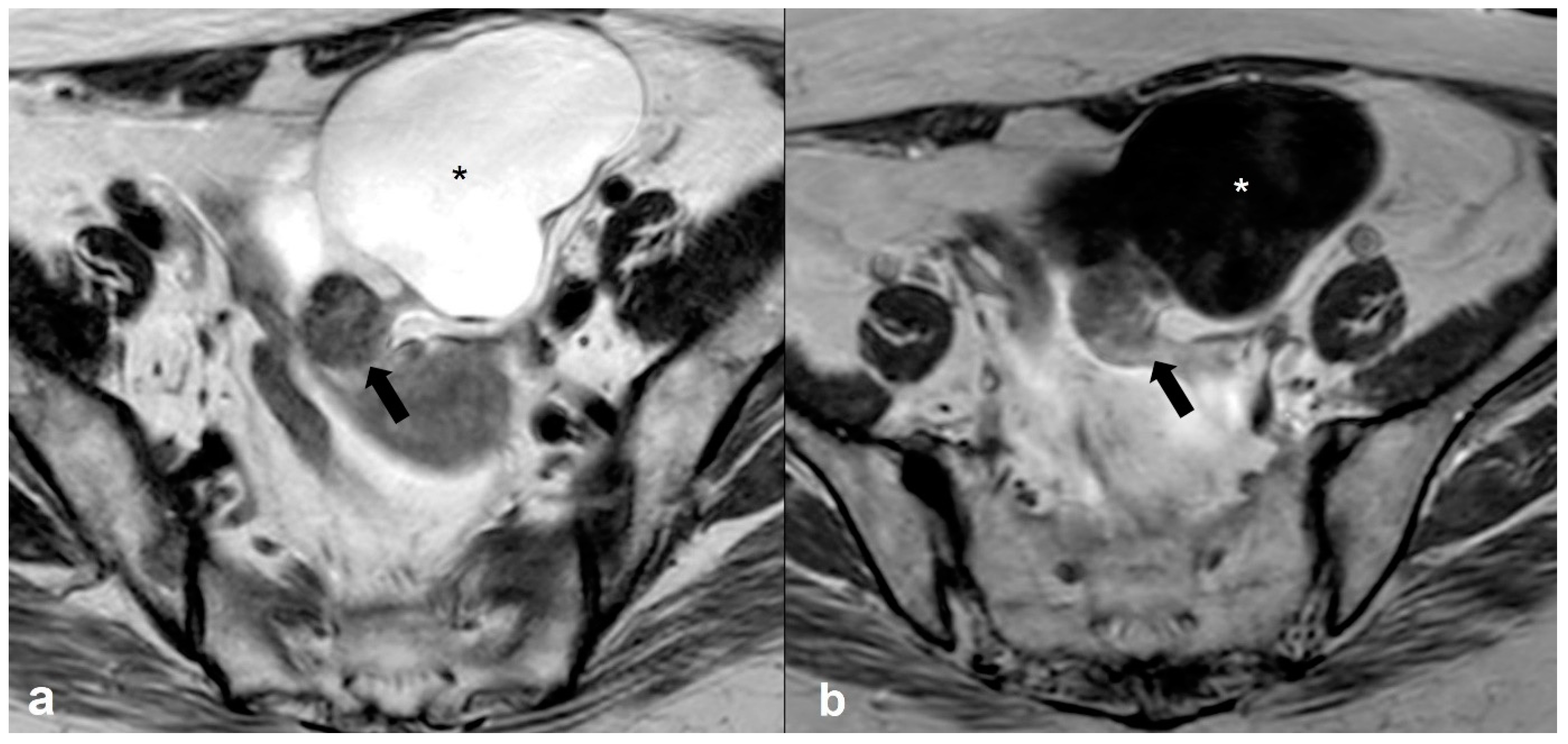 Cancers 15 02106 g014