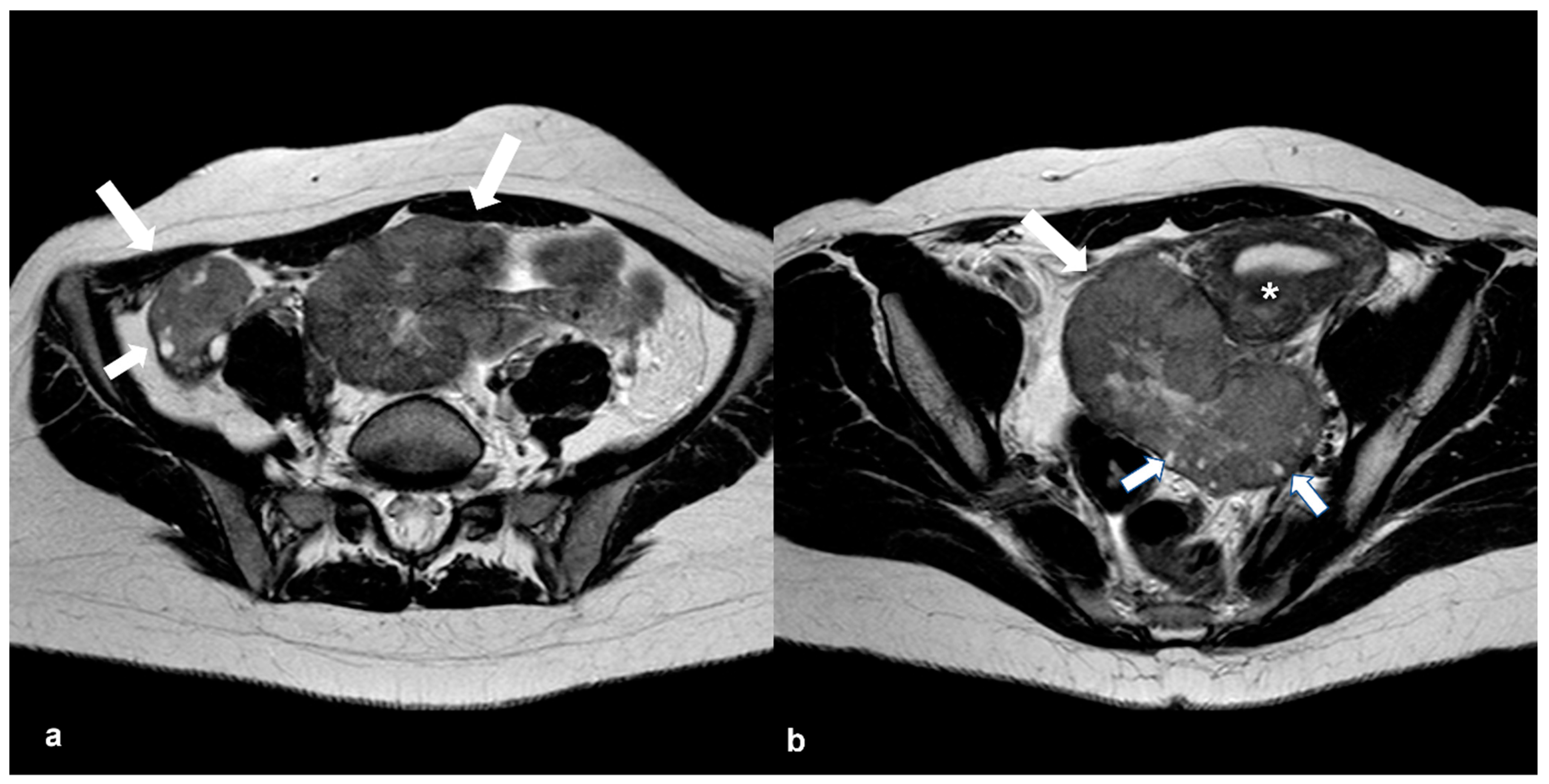 Cancers 15 02106 g015