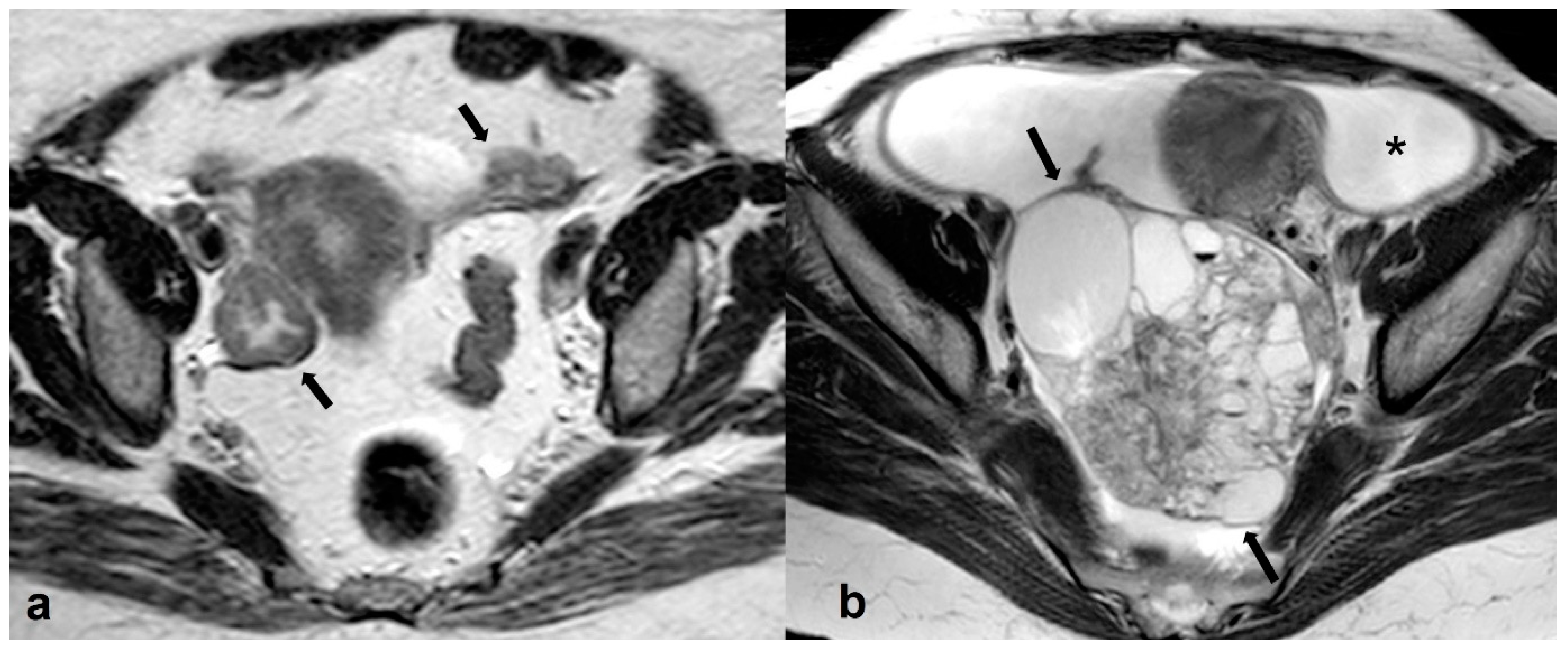 Cancers 15 02106 g016
