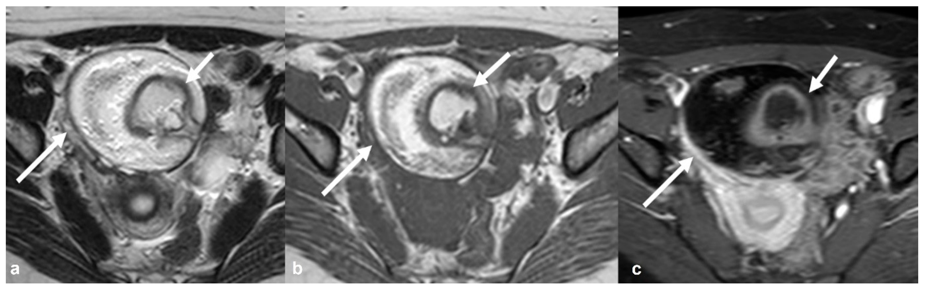 Cancers 15 02106 g017