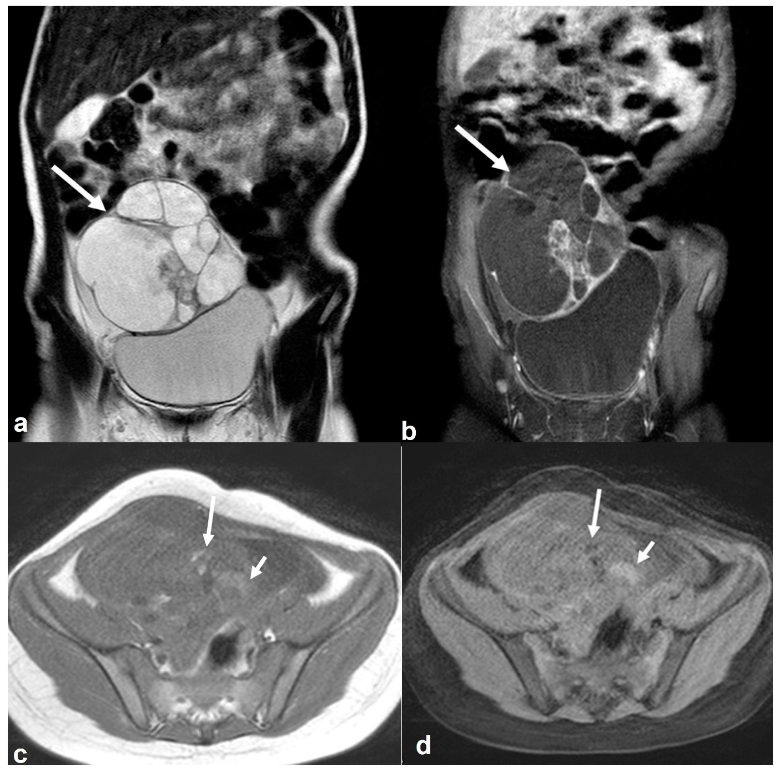 Cancers 15 02106 g018