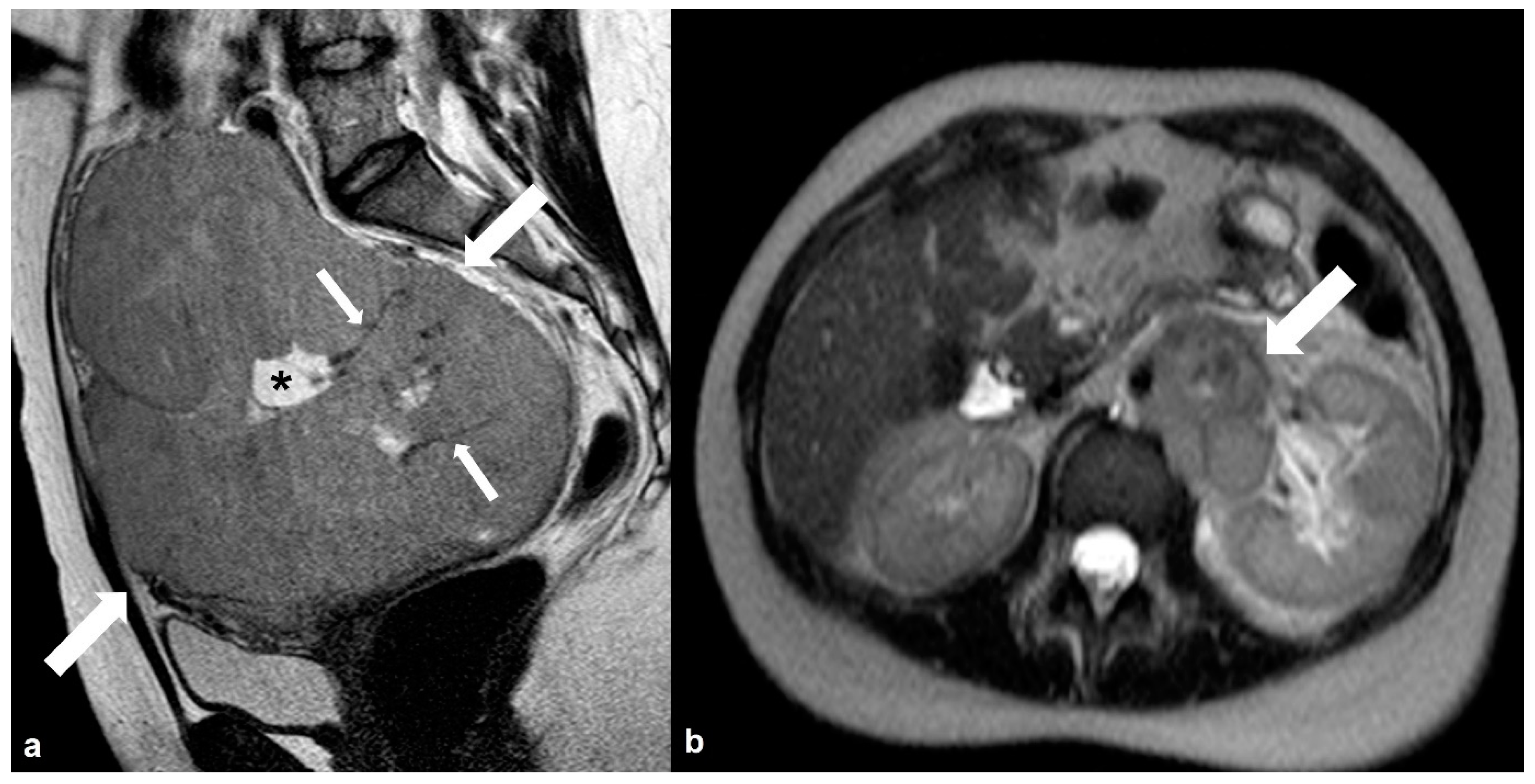 Cancers 15 02106 g019