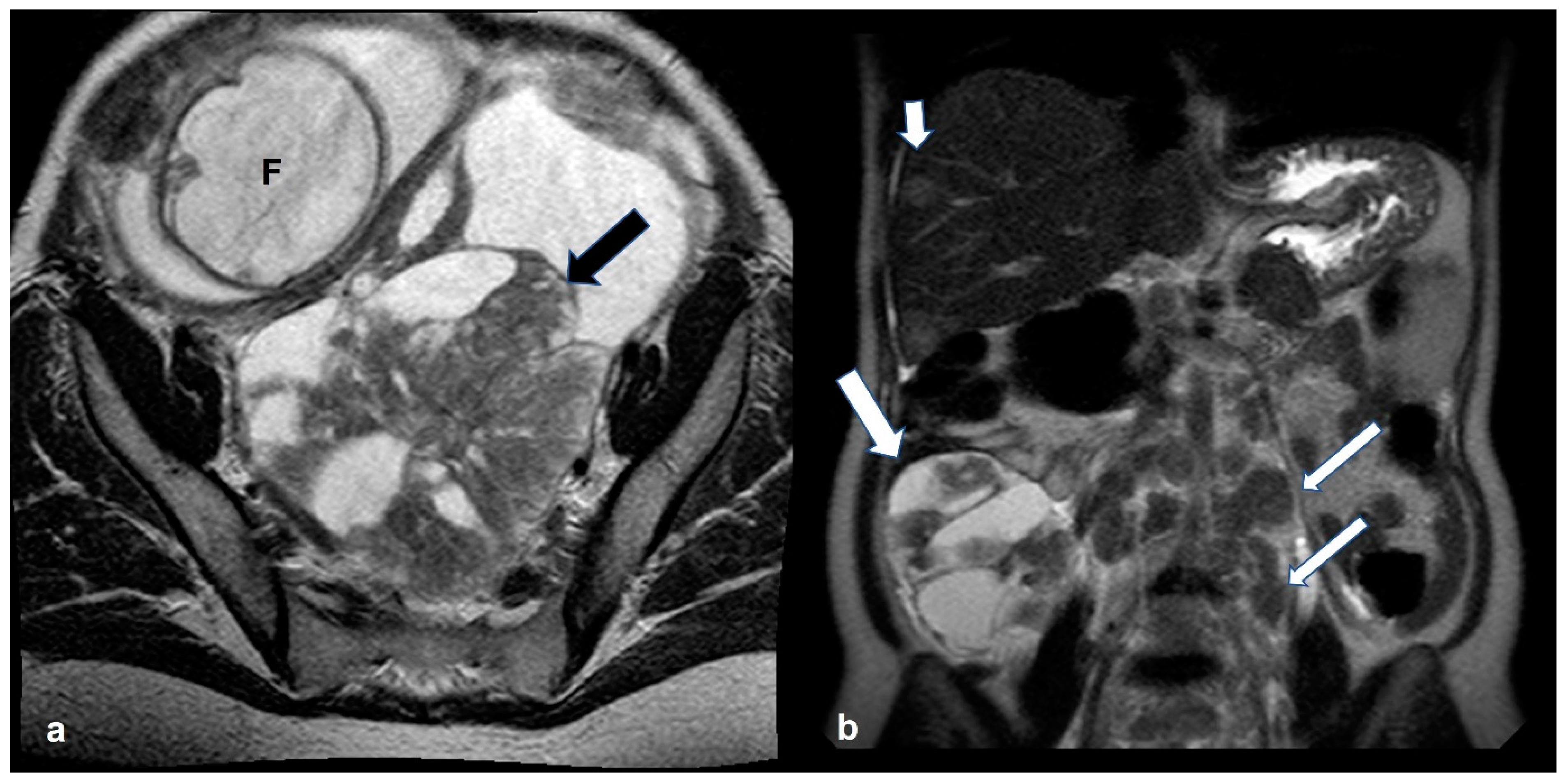 Cancers 15 02106 g021